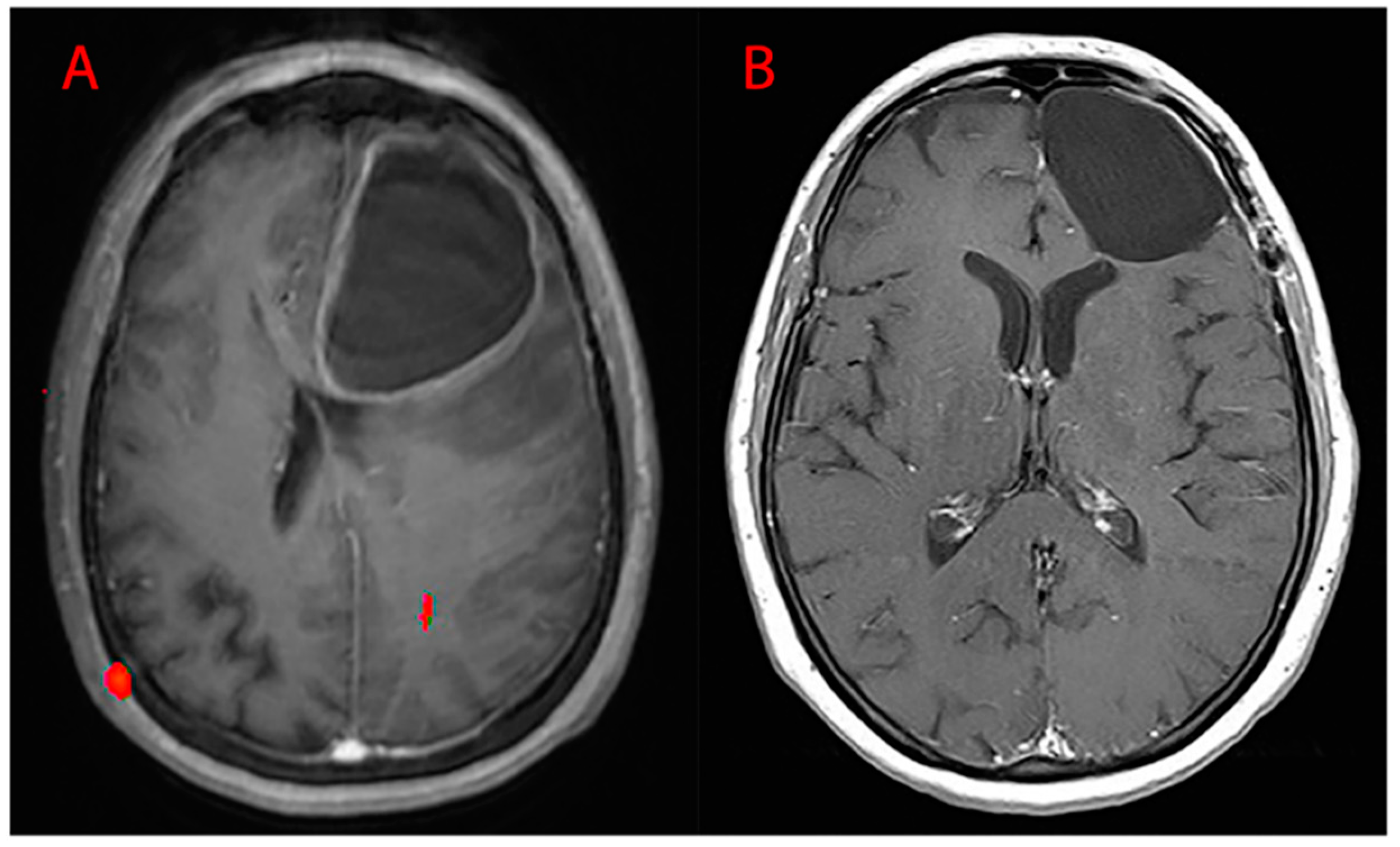 Brainsci 10 00091 g009