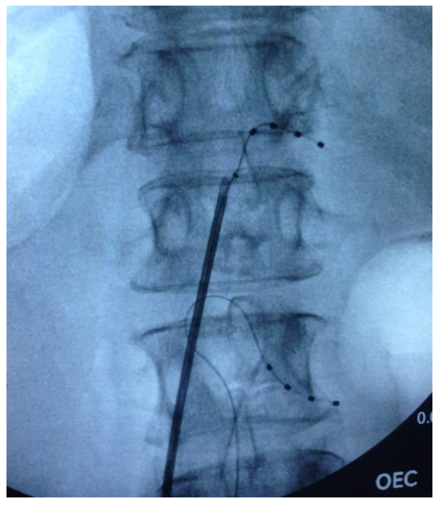 Brainsci 10 00095 g001