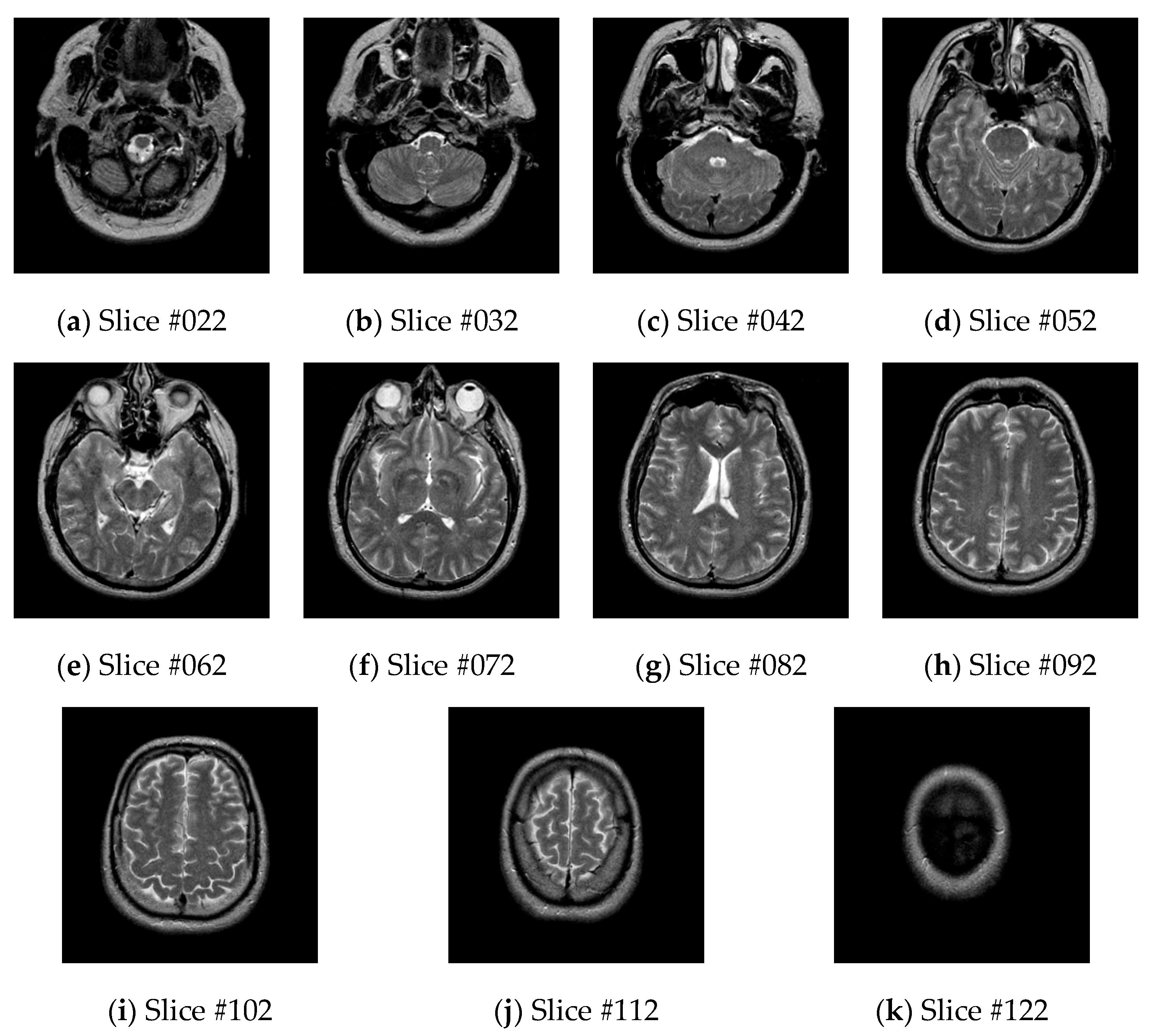 Brainsci 10 00116 g004