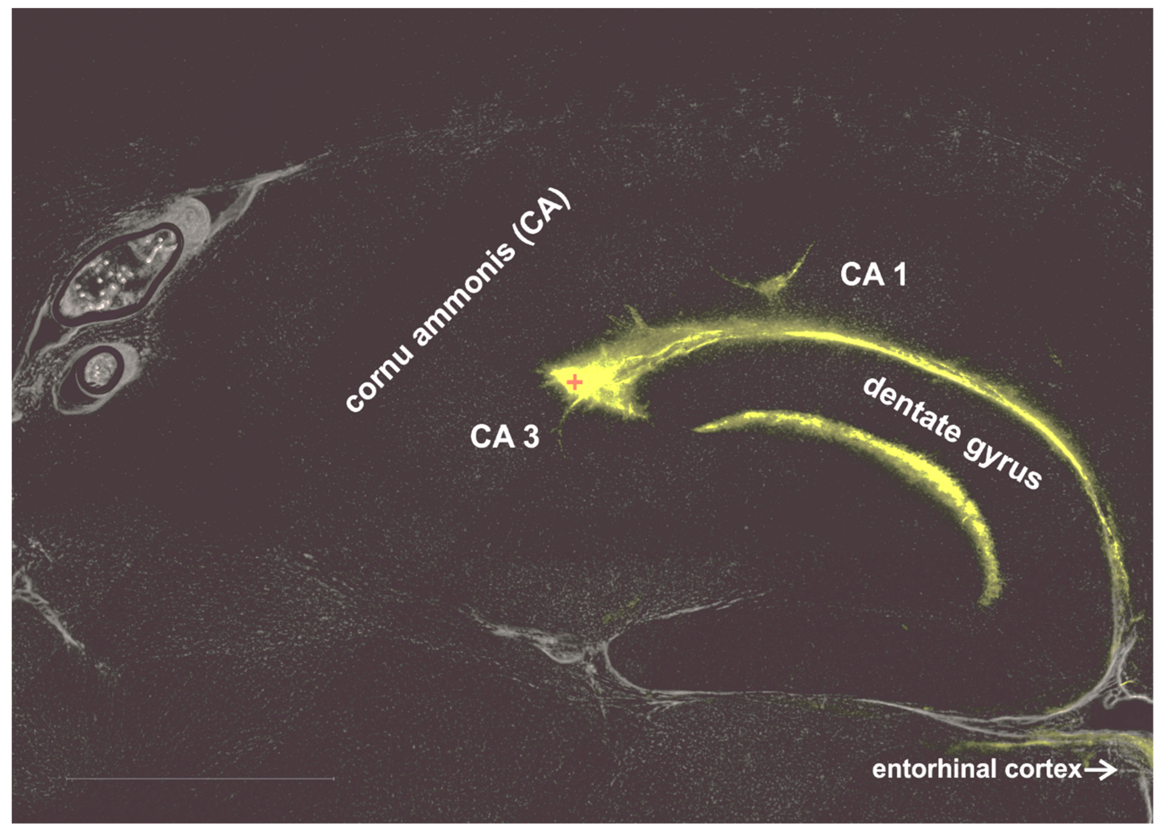 Brainsci 10 00123 g001 Brainsci 10 00123 g001