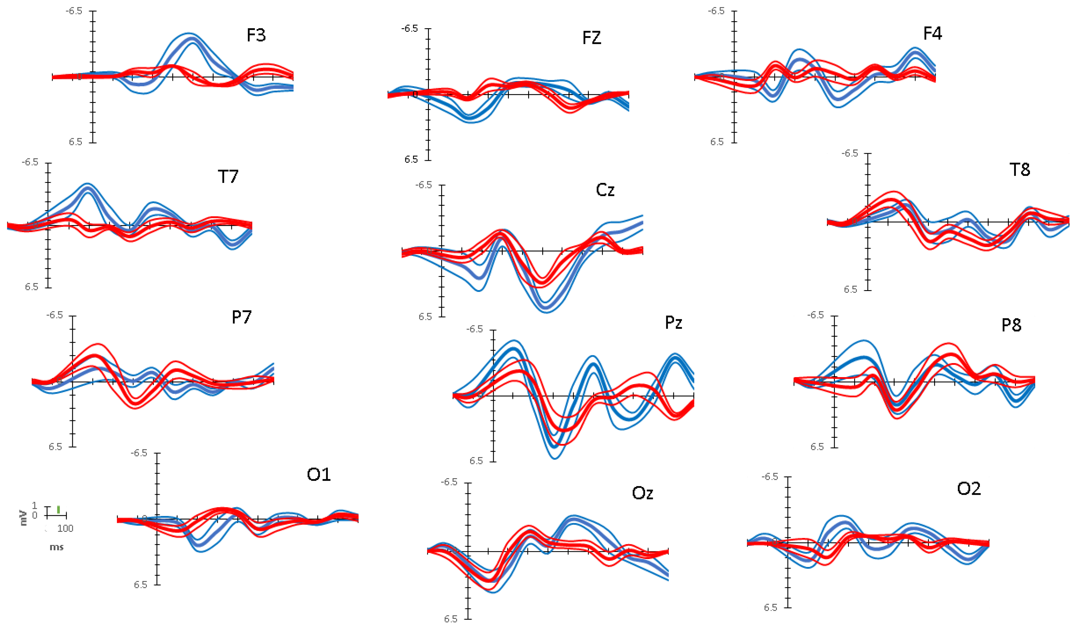 Brainsci 10 00124 g005 Brainsci 10 00124 g005