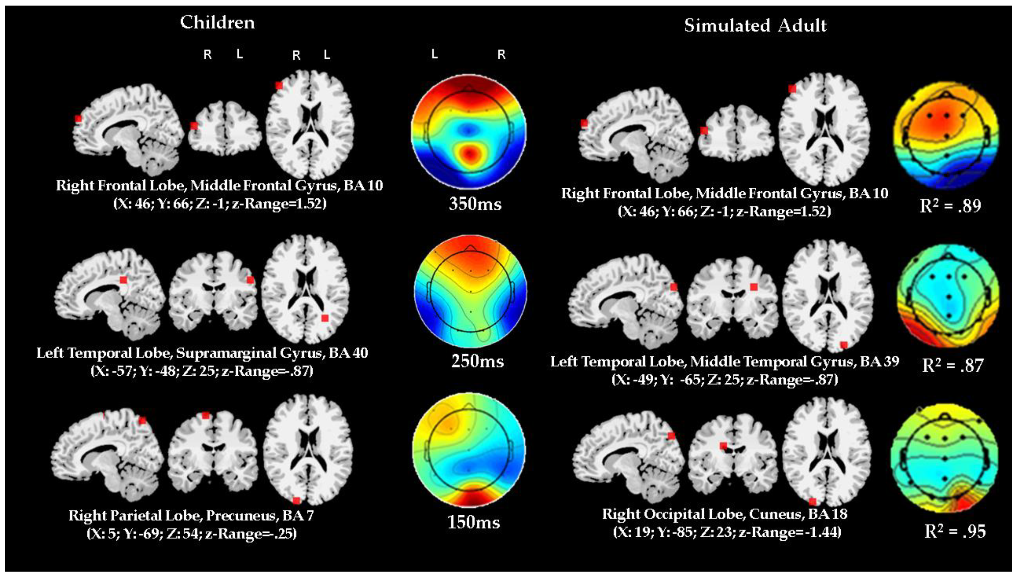 Brainsci 10 00124 g007b Brainsci 10 00124 g007b