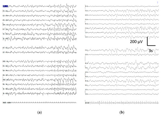 Brainsci 10 00158 g0a1
