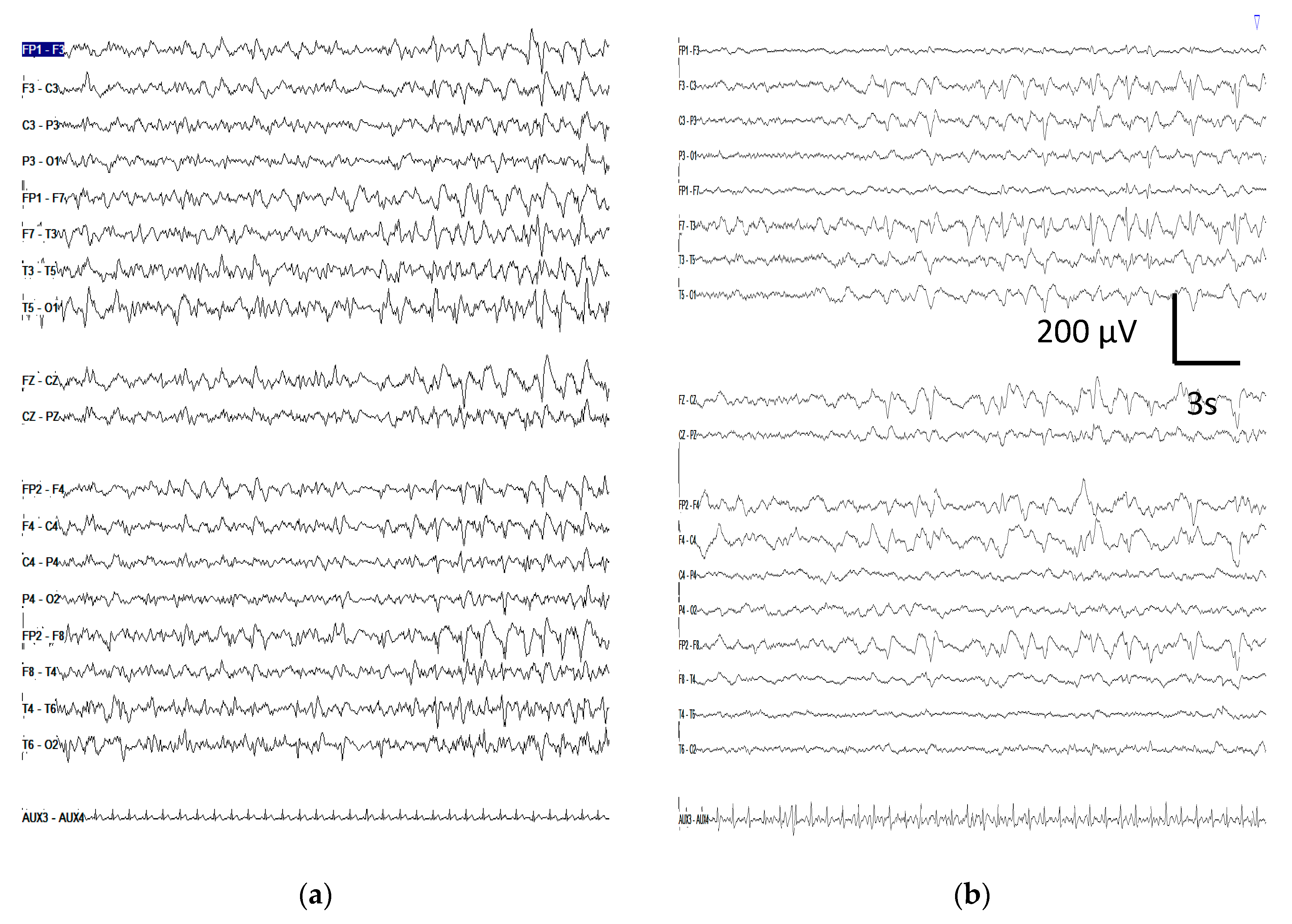 Brainsci 10 00158 g0a1