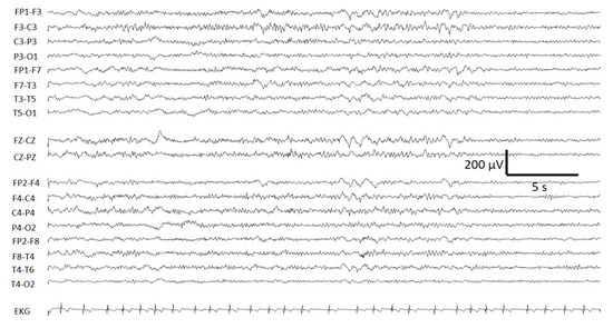 Brainsci 10 00158 g0a2