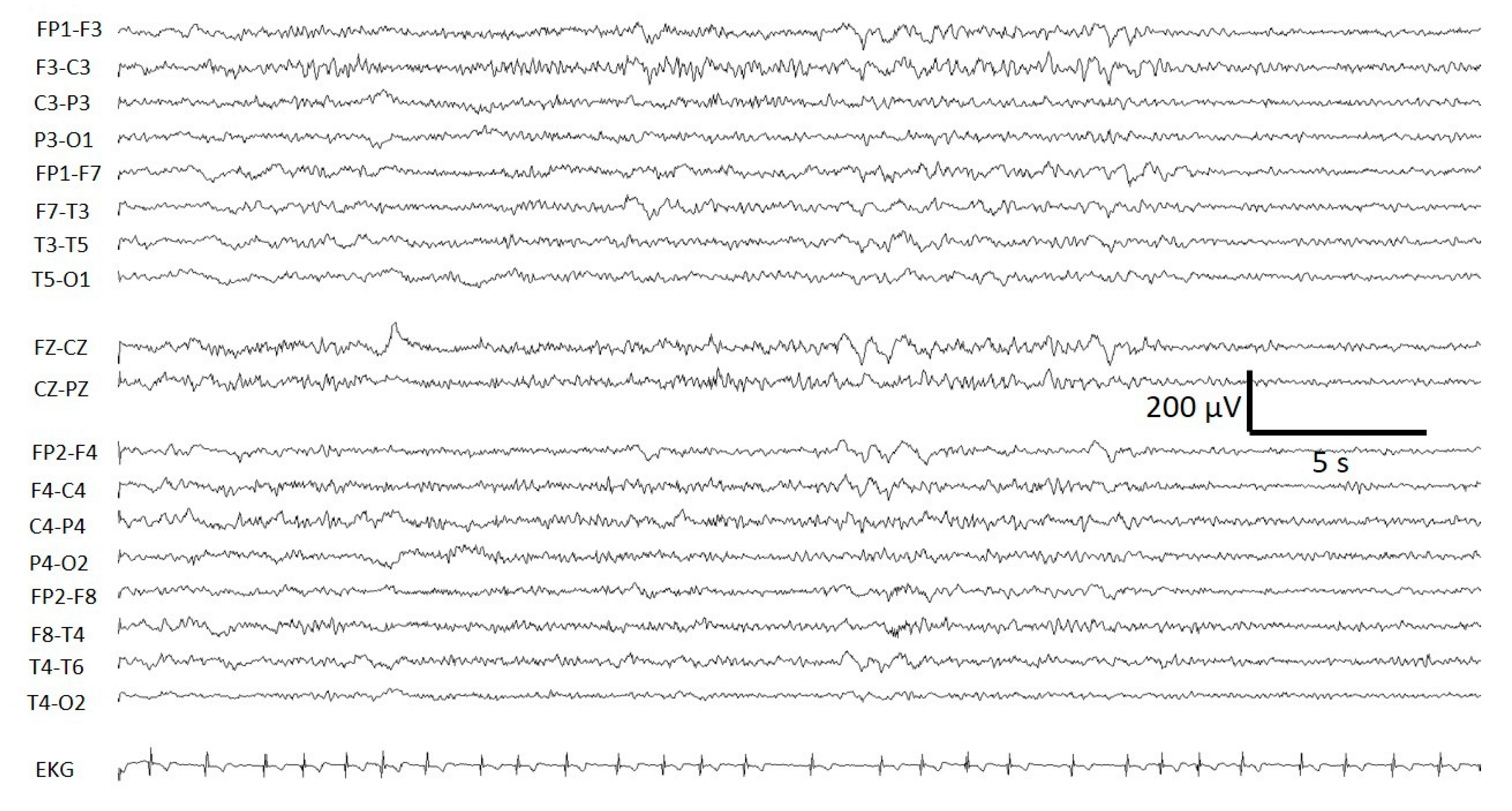 Brainsci 10 00158 g0a2