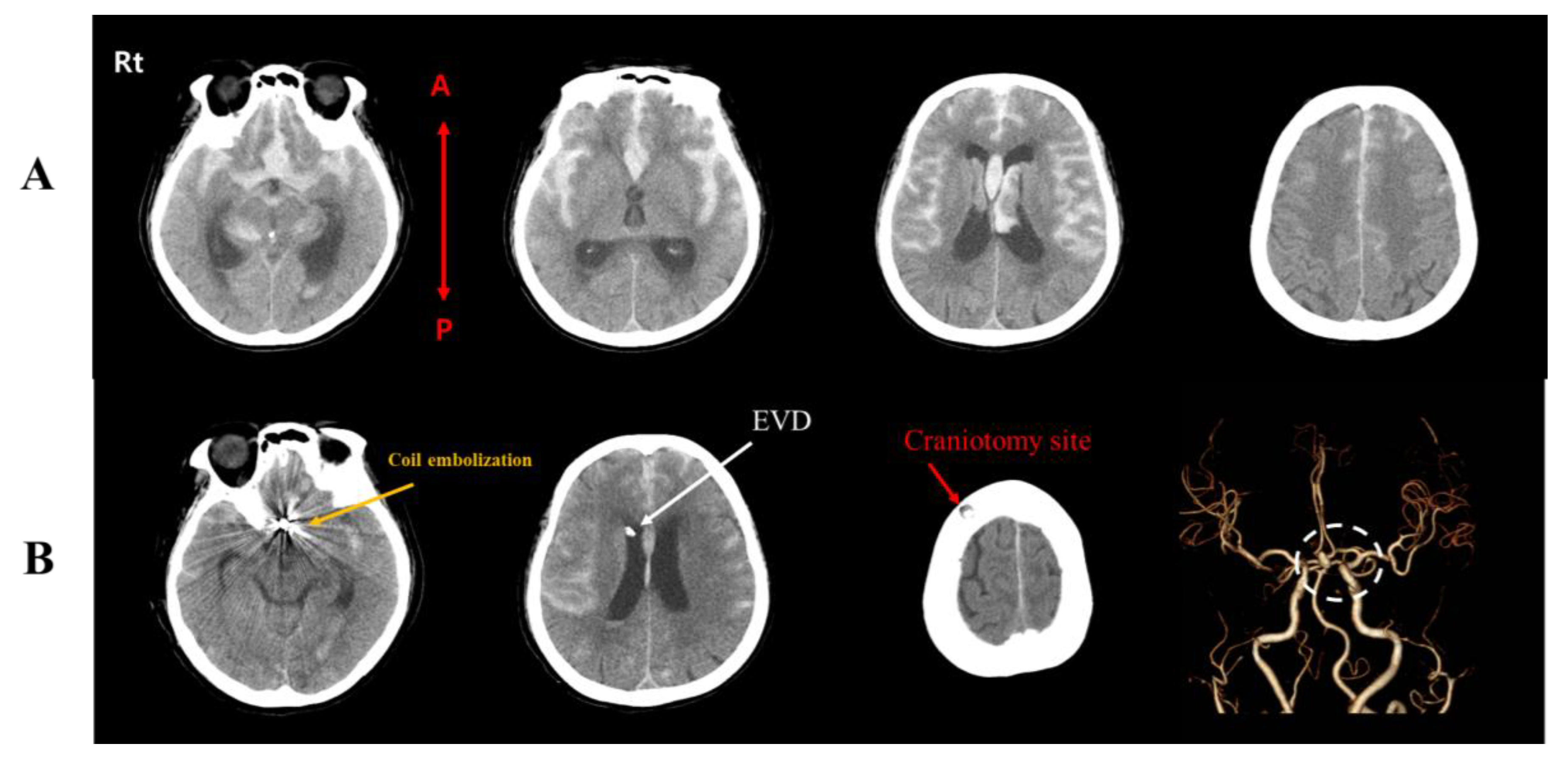 Brainsci 10 00177 g001 Brainsci 10 00177 g001