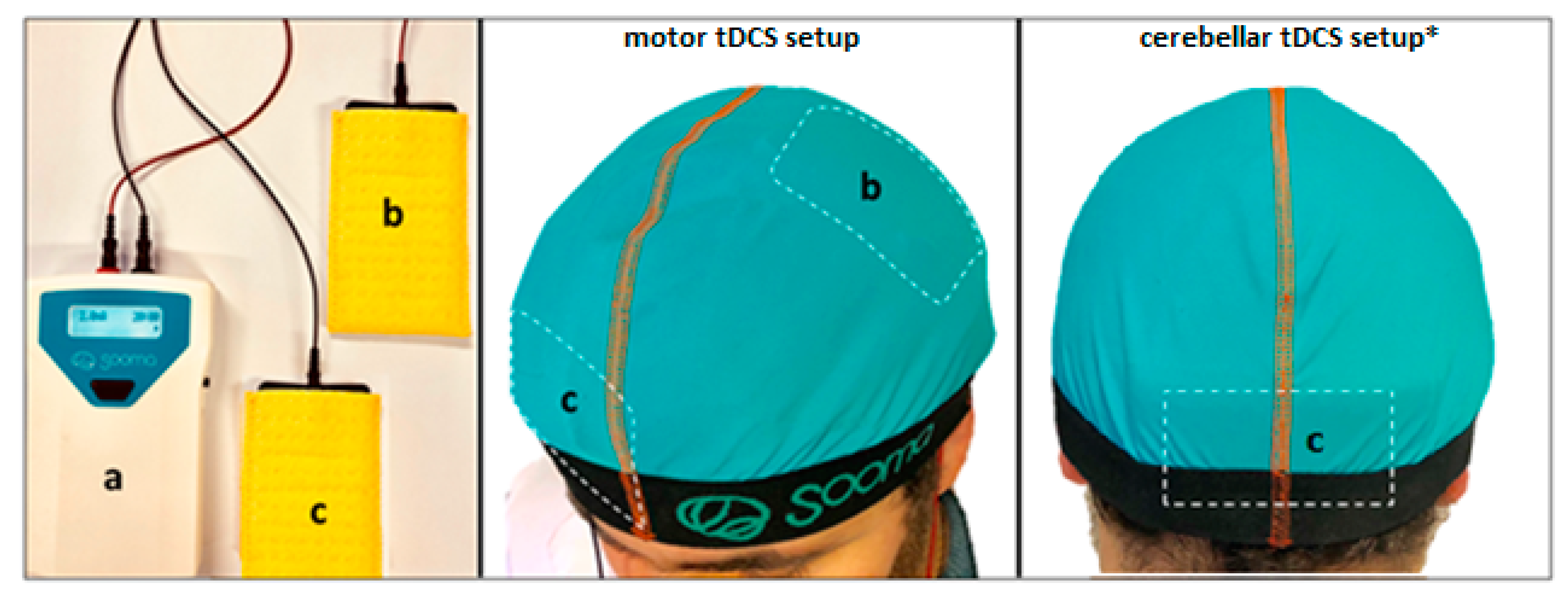 Brainsci 10 00185 g001 Brainsci 10 00185 g001