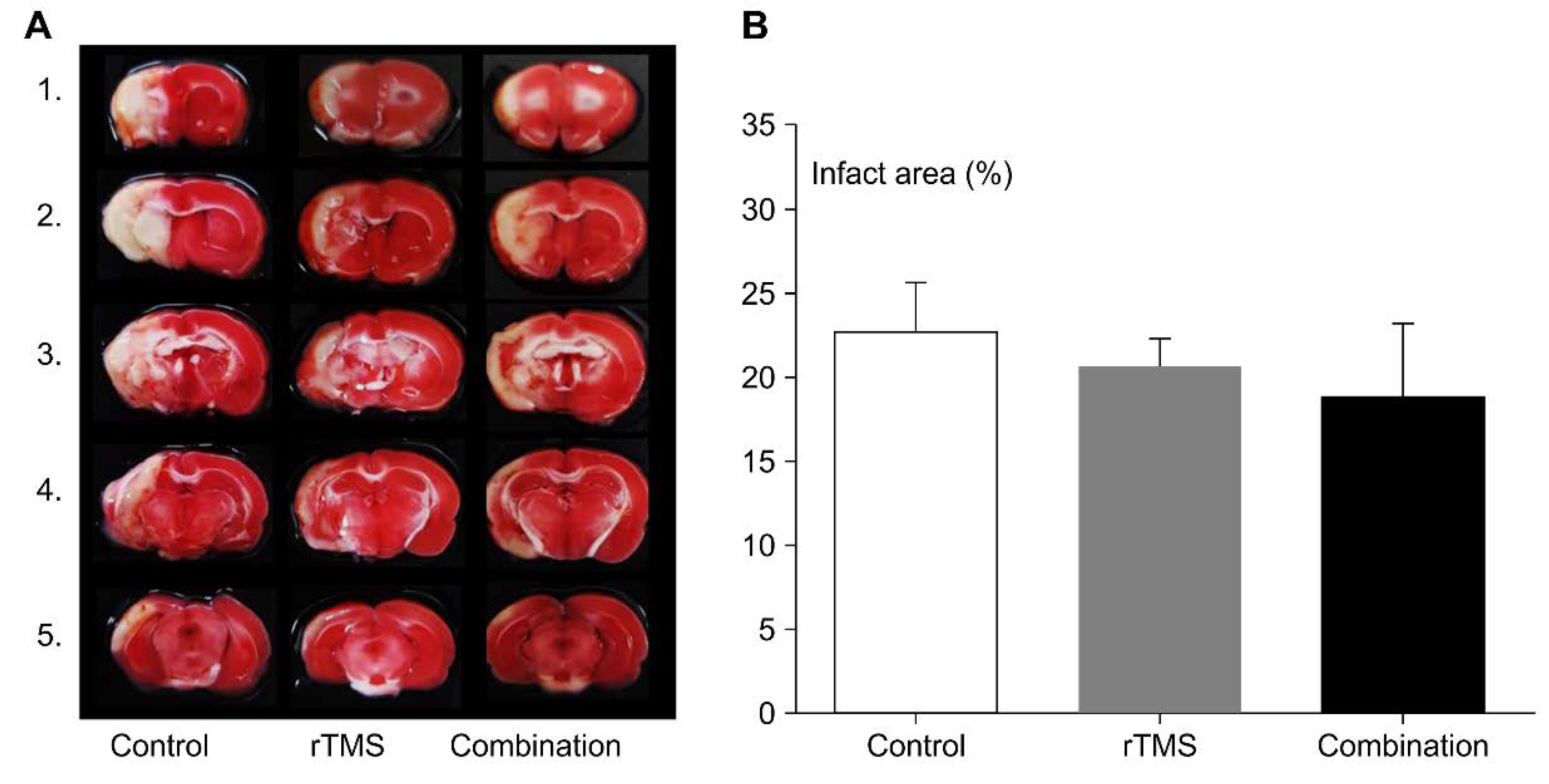 Brainsci 10 00186 g006 Brainsci 10 00186 g006