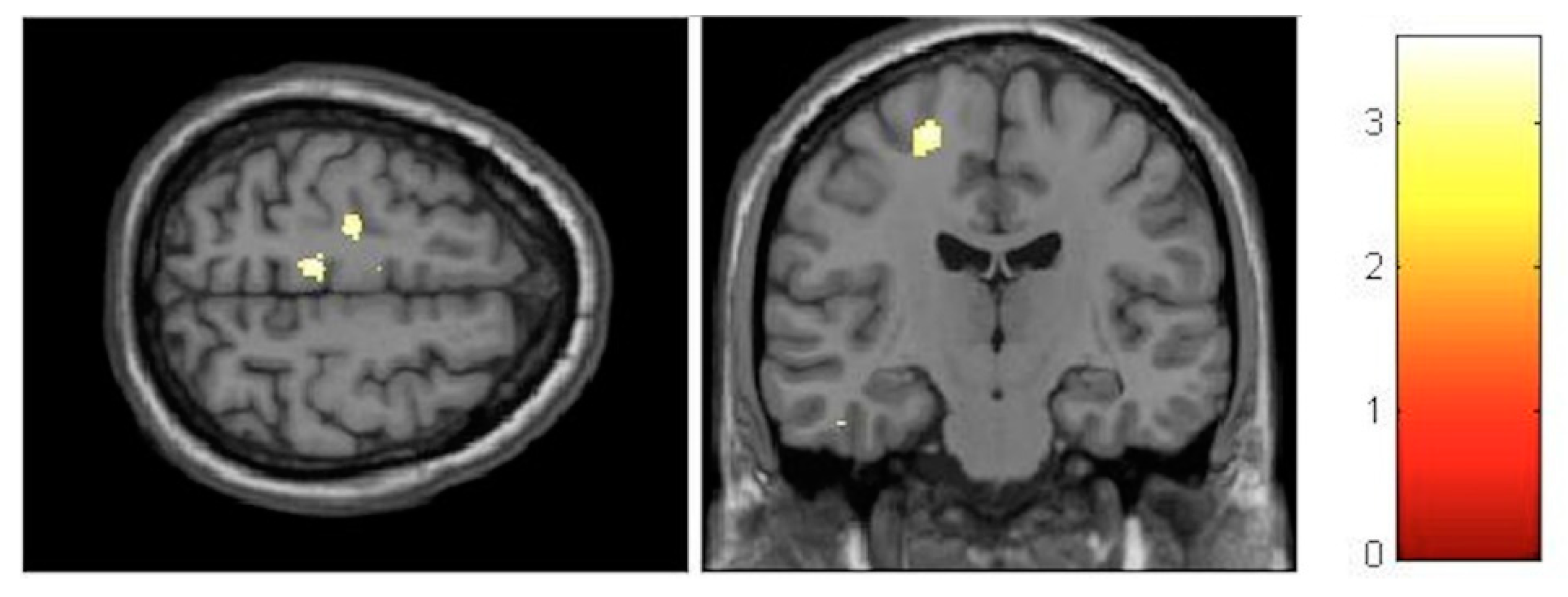 Brainsci 10 00210 g004