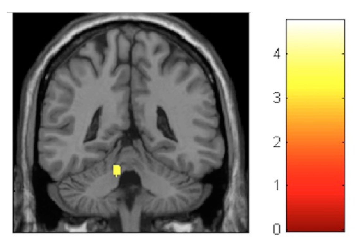 Brainsci 10 00210 g005