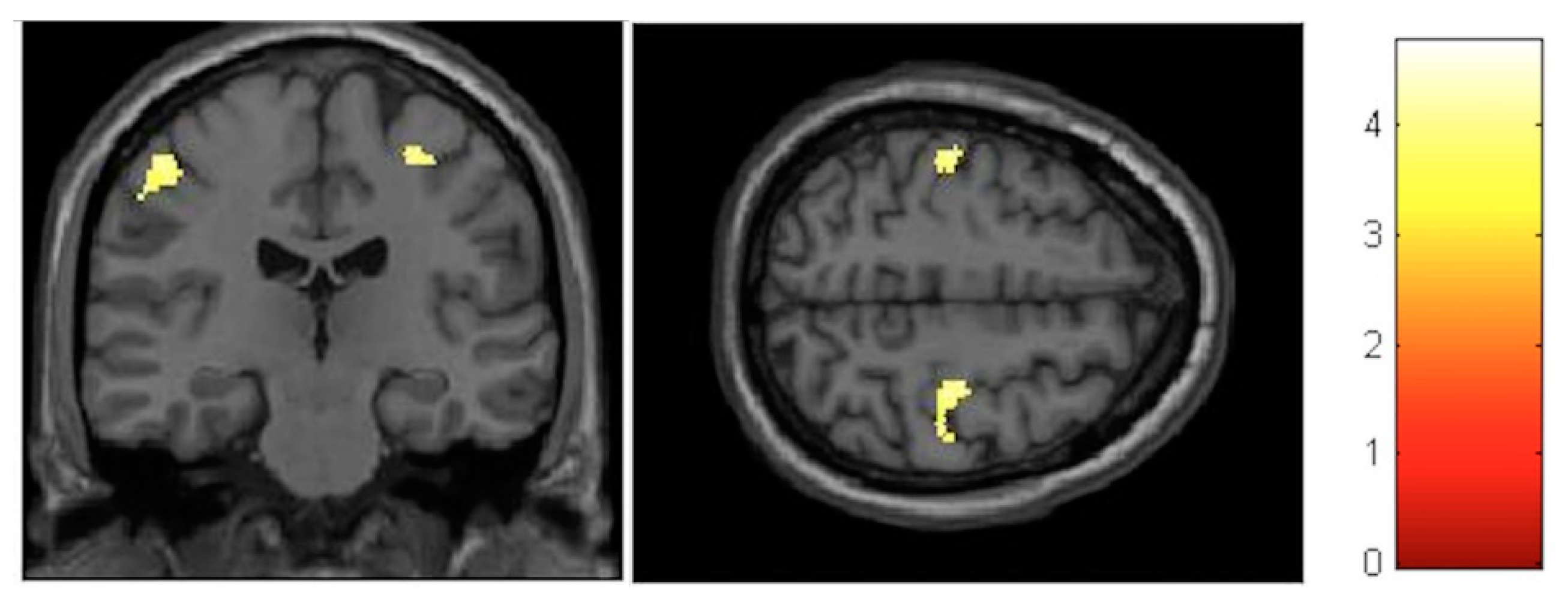 Brainsci 10 00210 g006