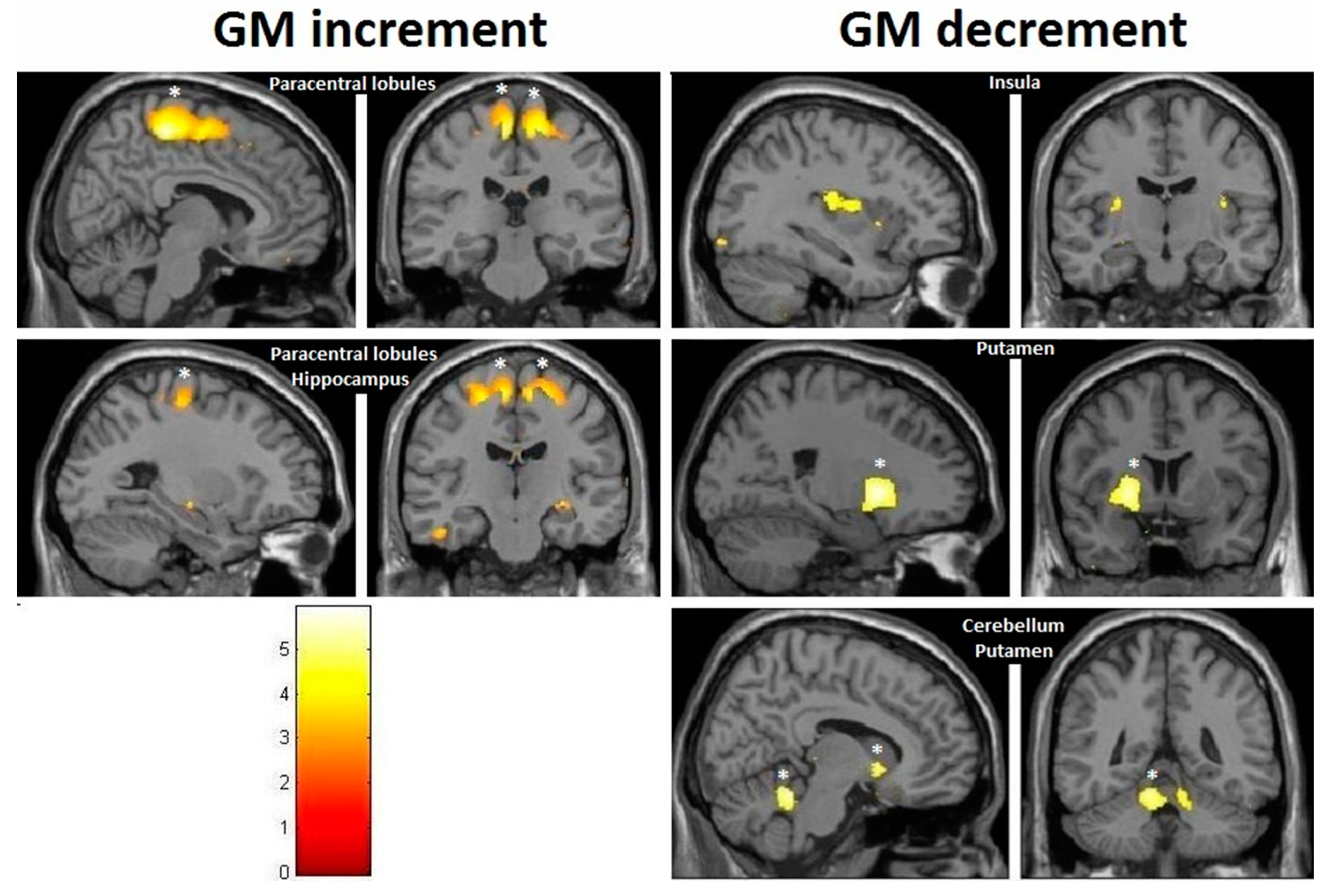 Brainsci 10 00210 g008