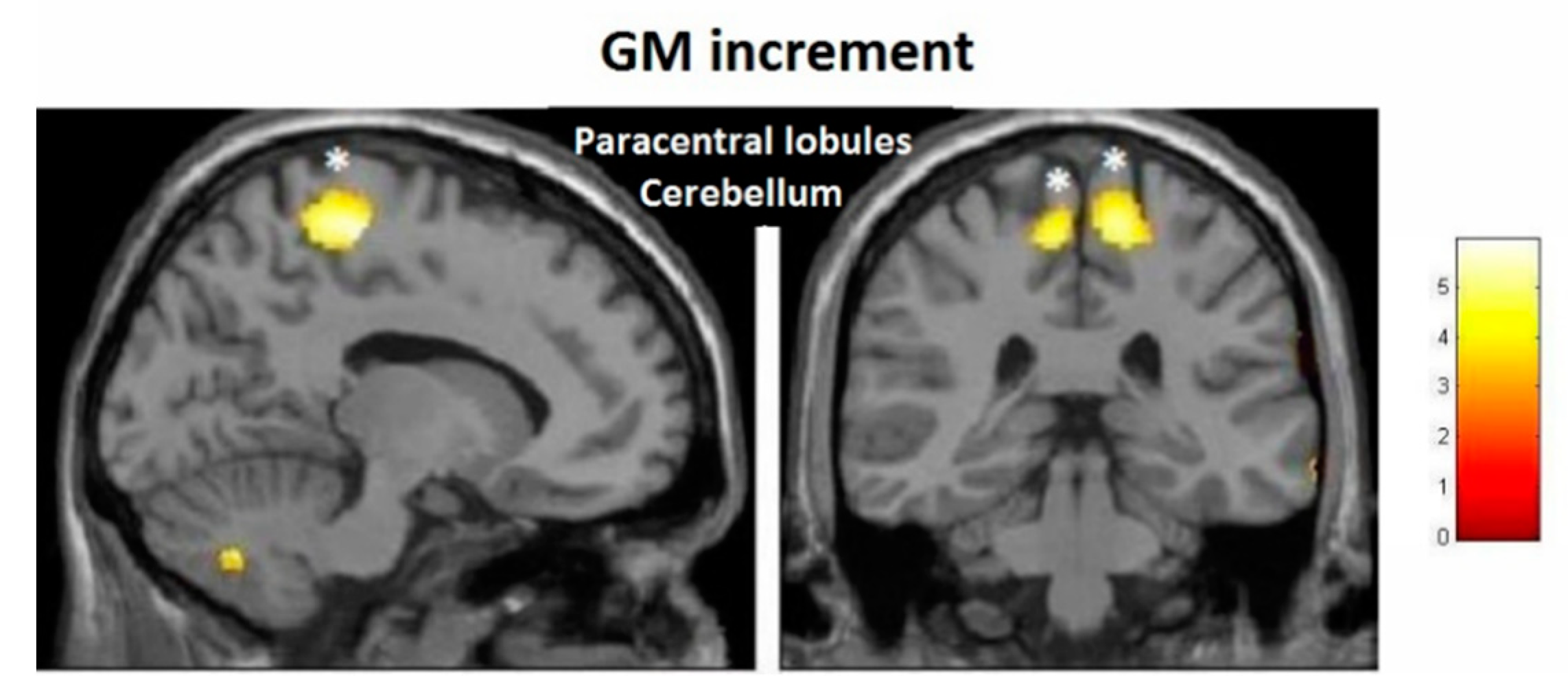 Brainsci 10 00210 g010