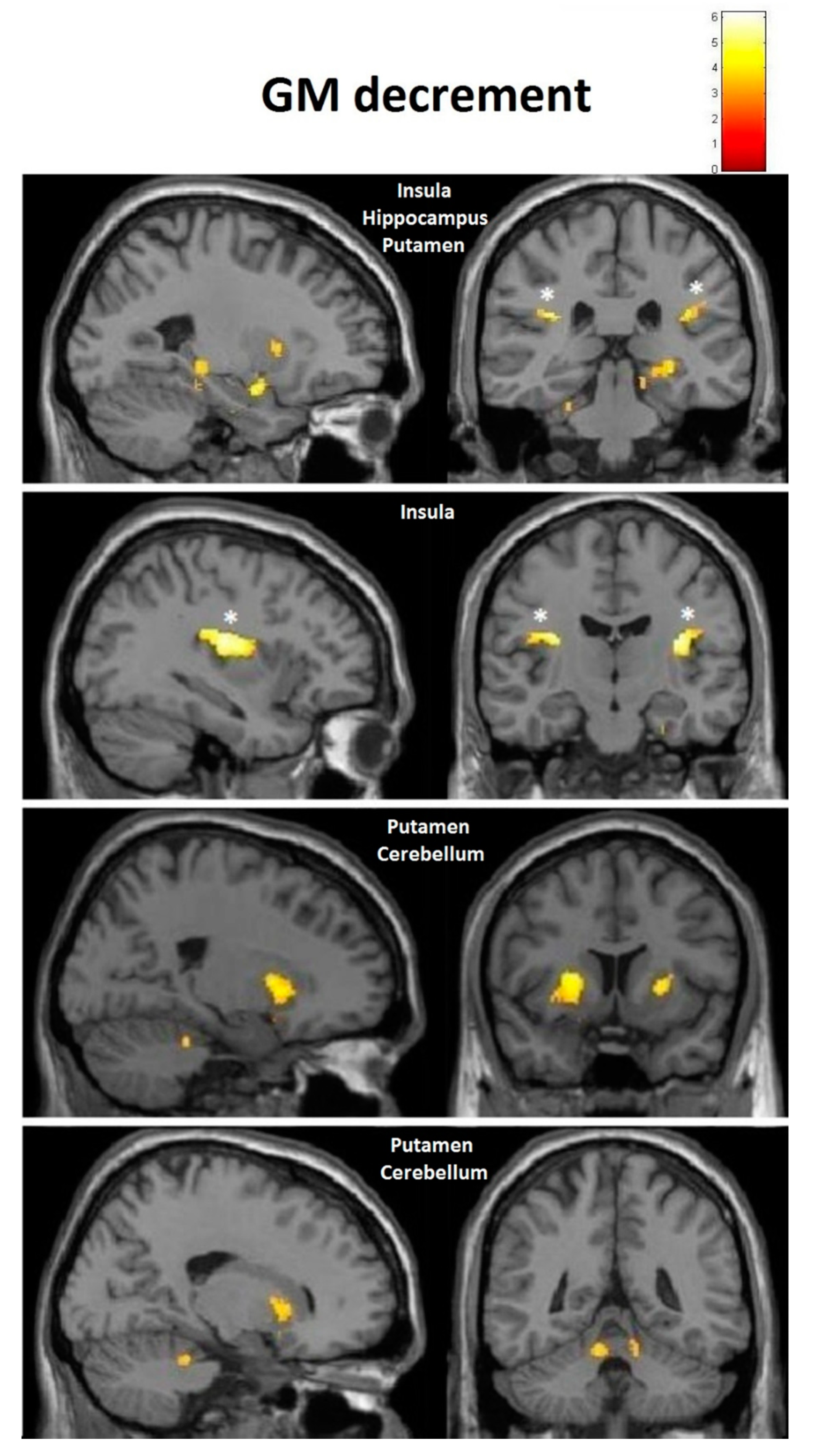 Brainsci 10 00210 g011