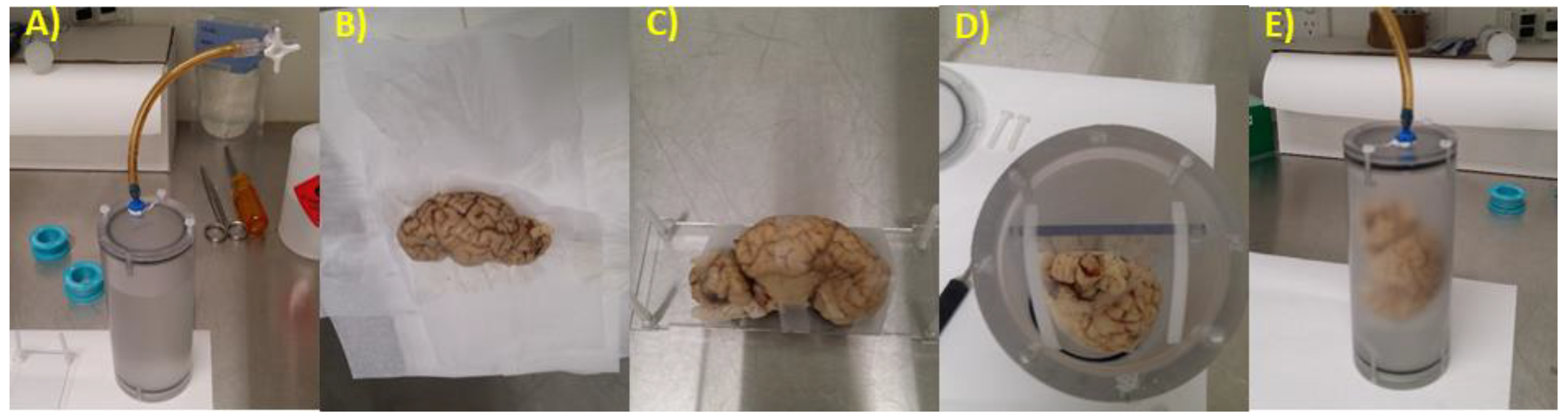 Brainsci 10 00211 g001 Brainsci 10 00211 g001