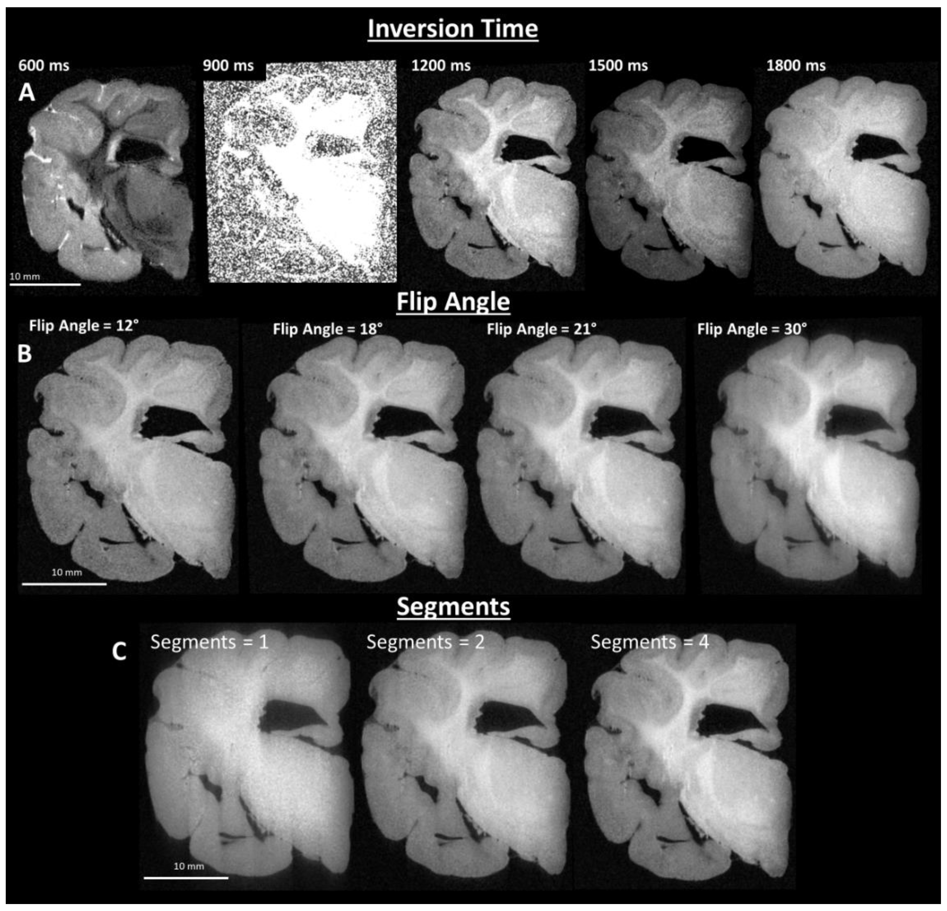 Brainsci 10 00211 g002 Brainsci 10 00211 g002