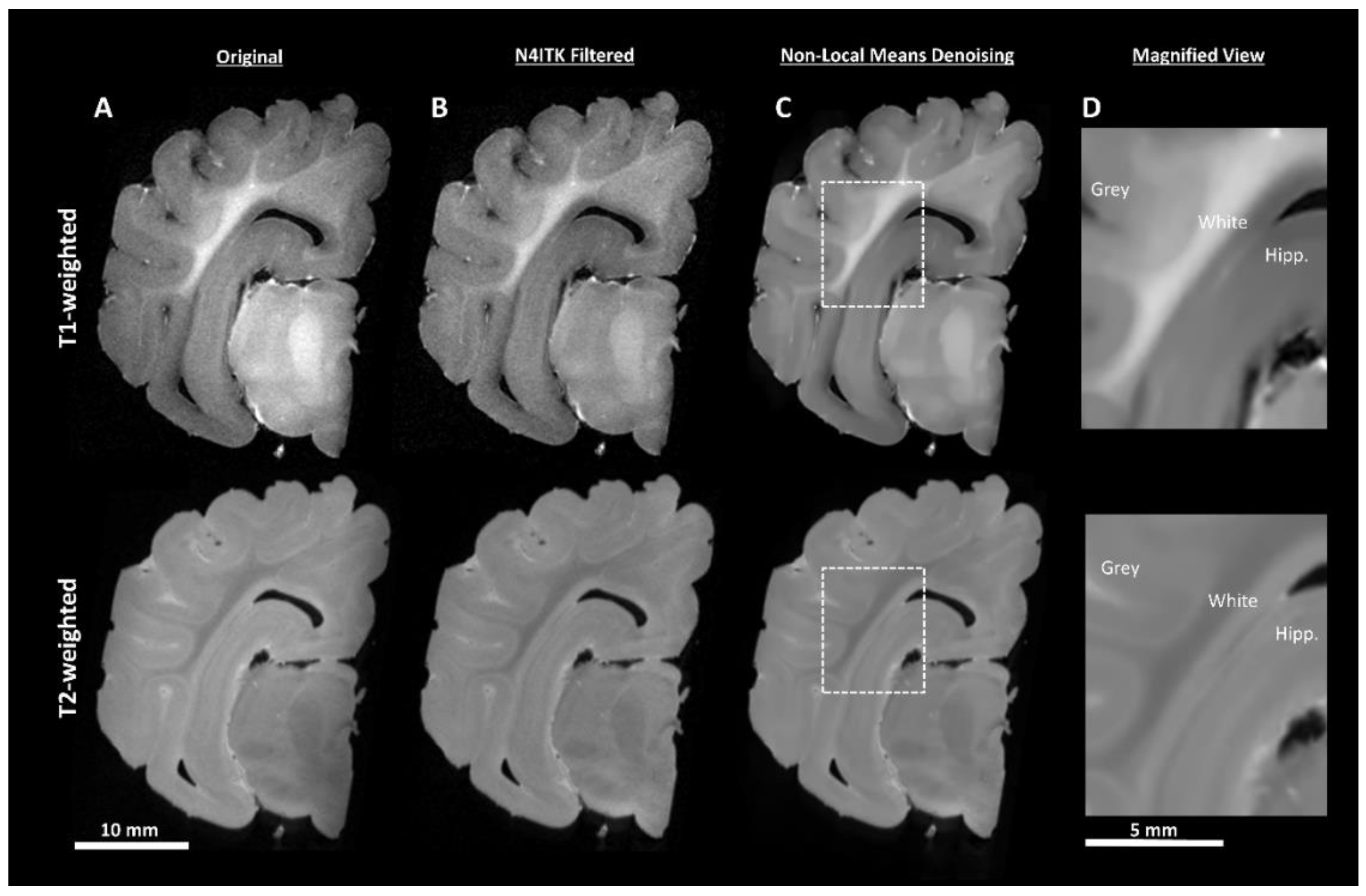 Brainsci 10 00211 g003 Brainsci 10 00211 g003