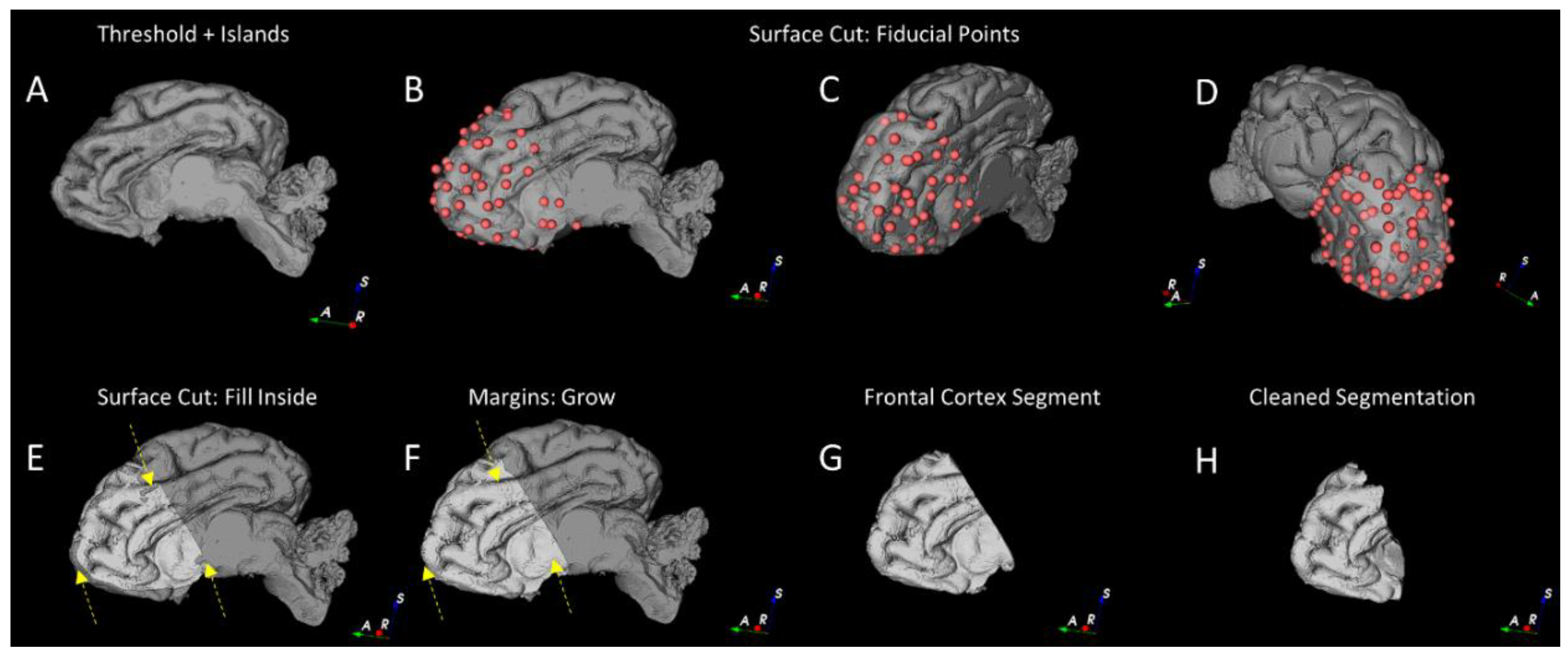 Brainsci 10 00211 g004 Brainsci 10 00211 g004