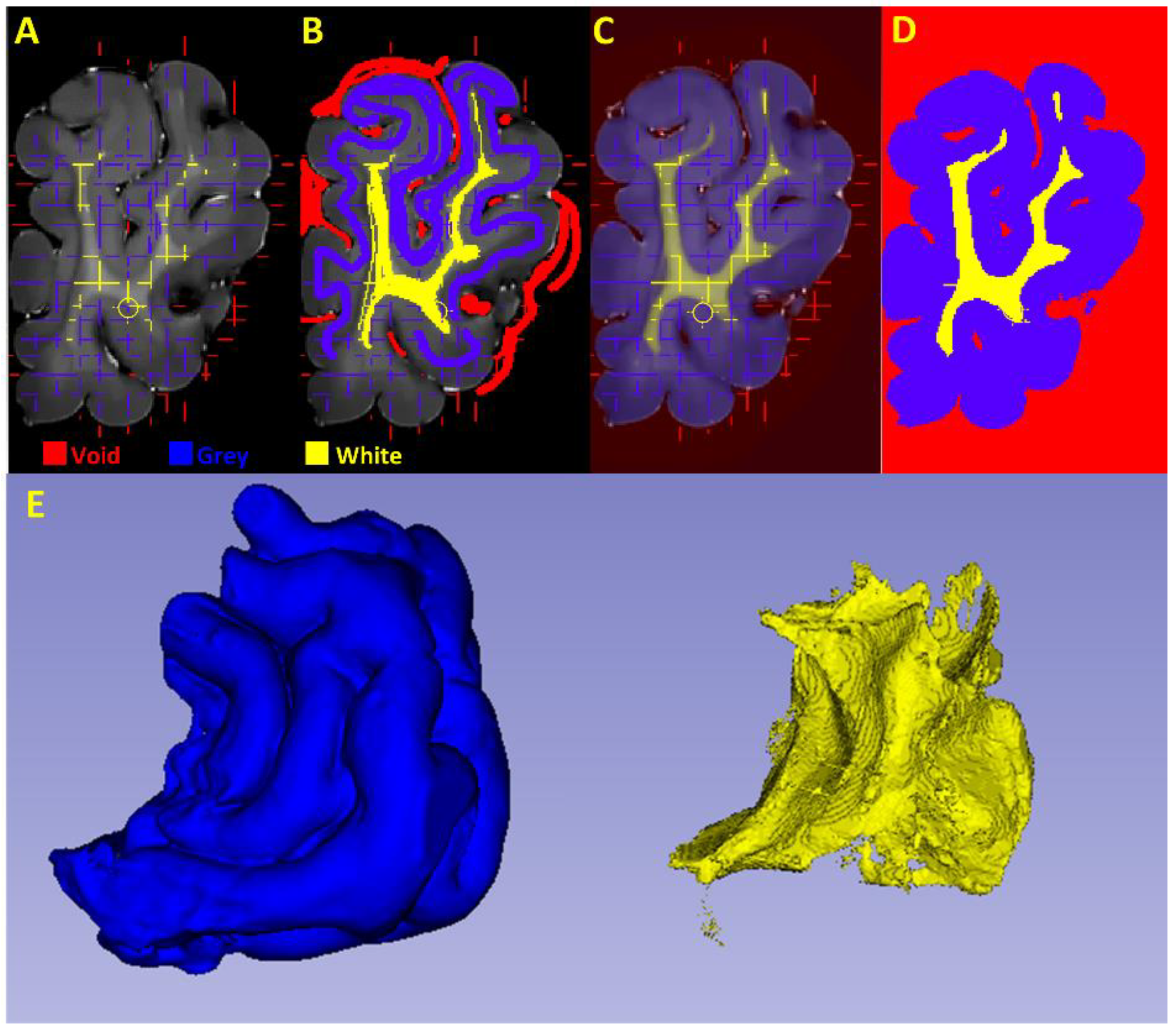 Brainsci 10 00211 g005 Brainsci 10 00211 g005