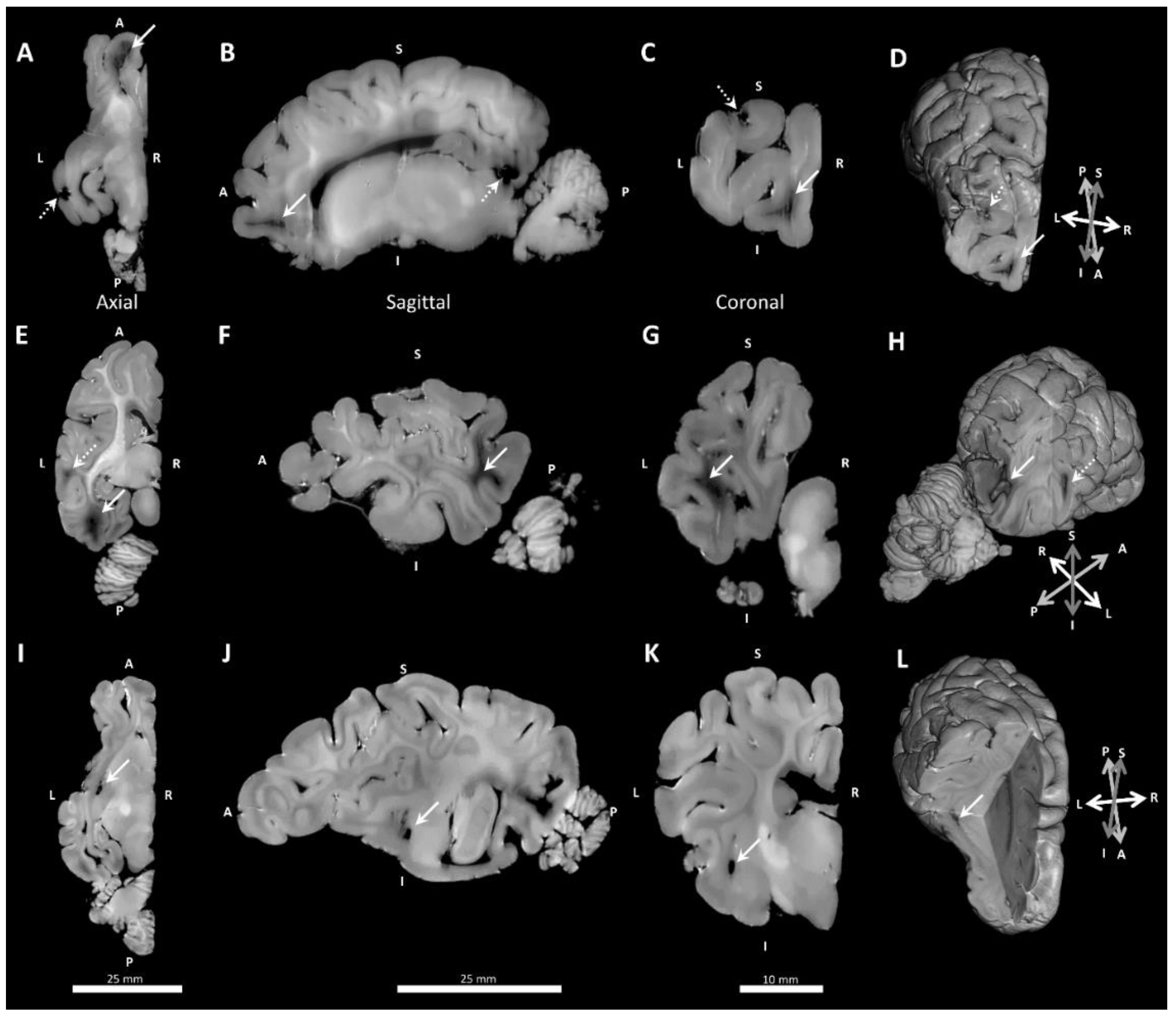 Brainsci 10 00211 g007 Brainsci 10 00211 g007