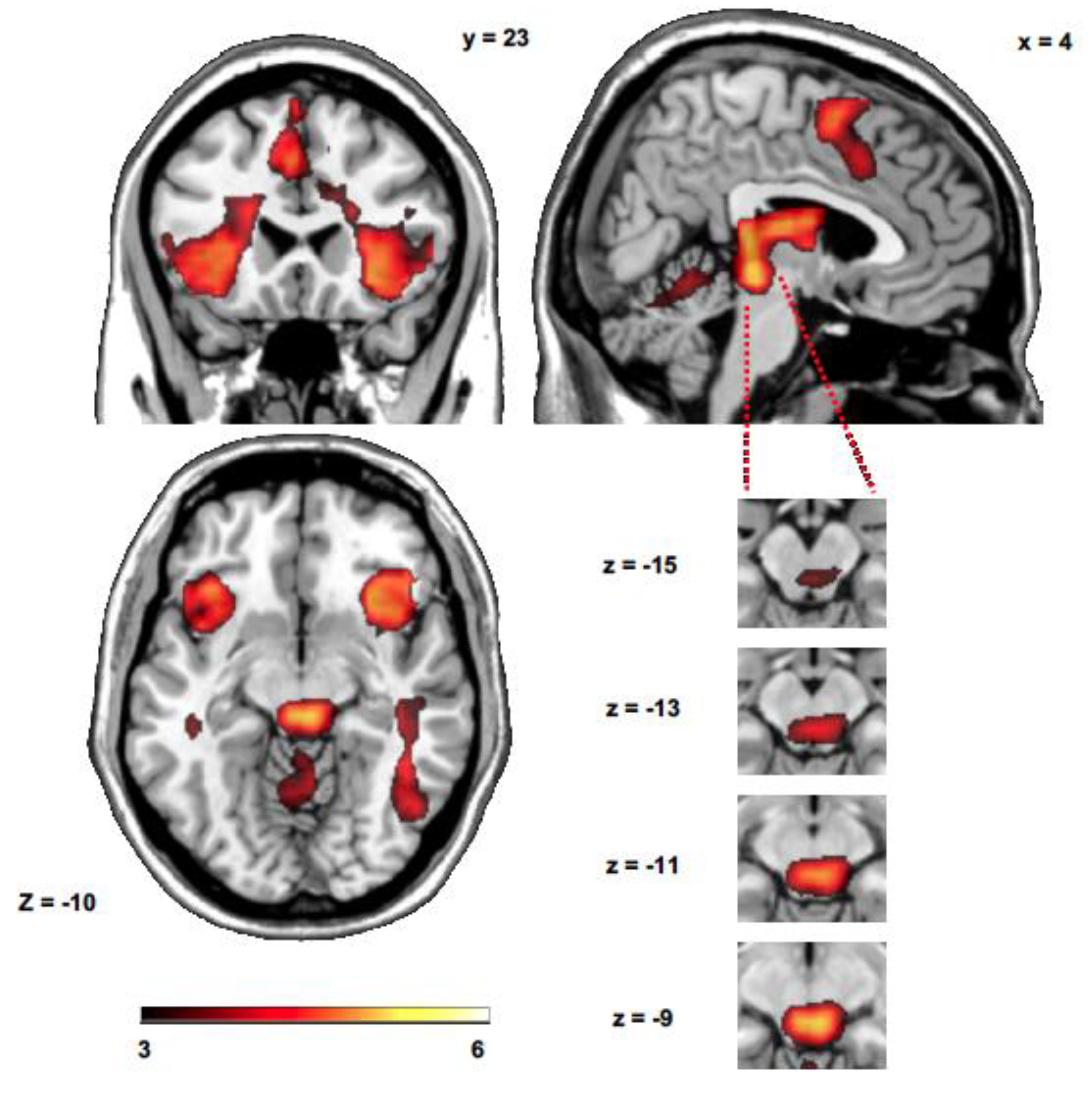 Brainsci 10 00223 g002