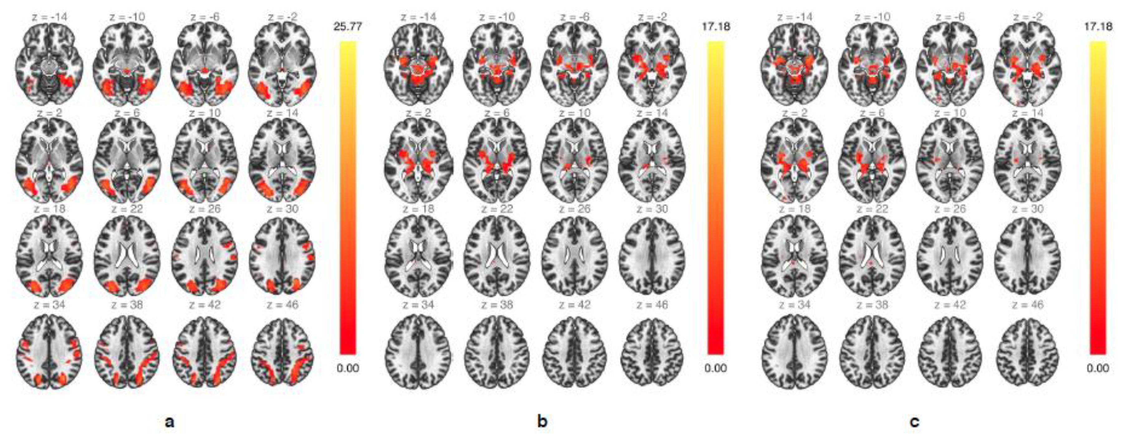 Brainsci 10 00223 g003
