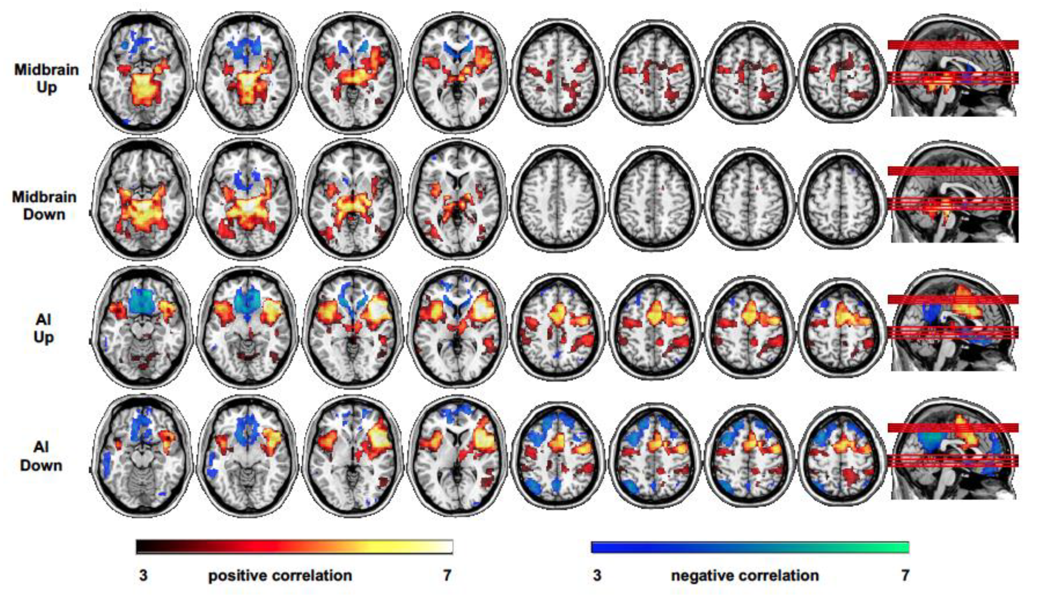 Brainsci 10 00223 g004