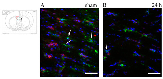 Brainsci 10 00229 g007a Brainsci 10 00229 g007a