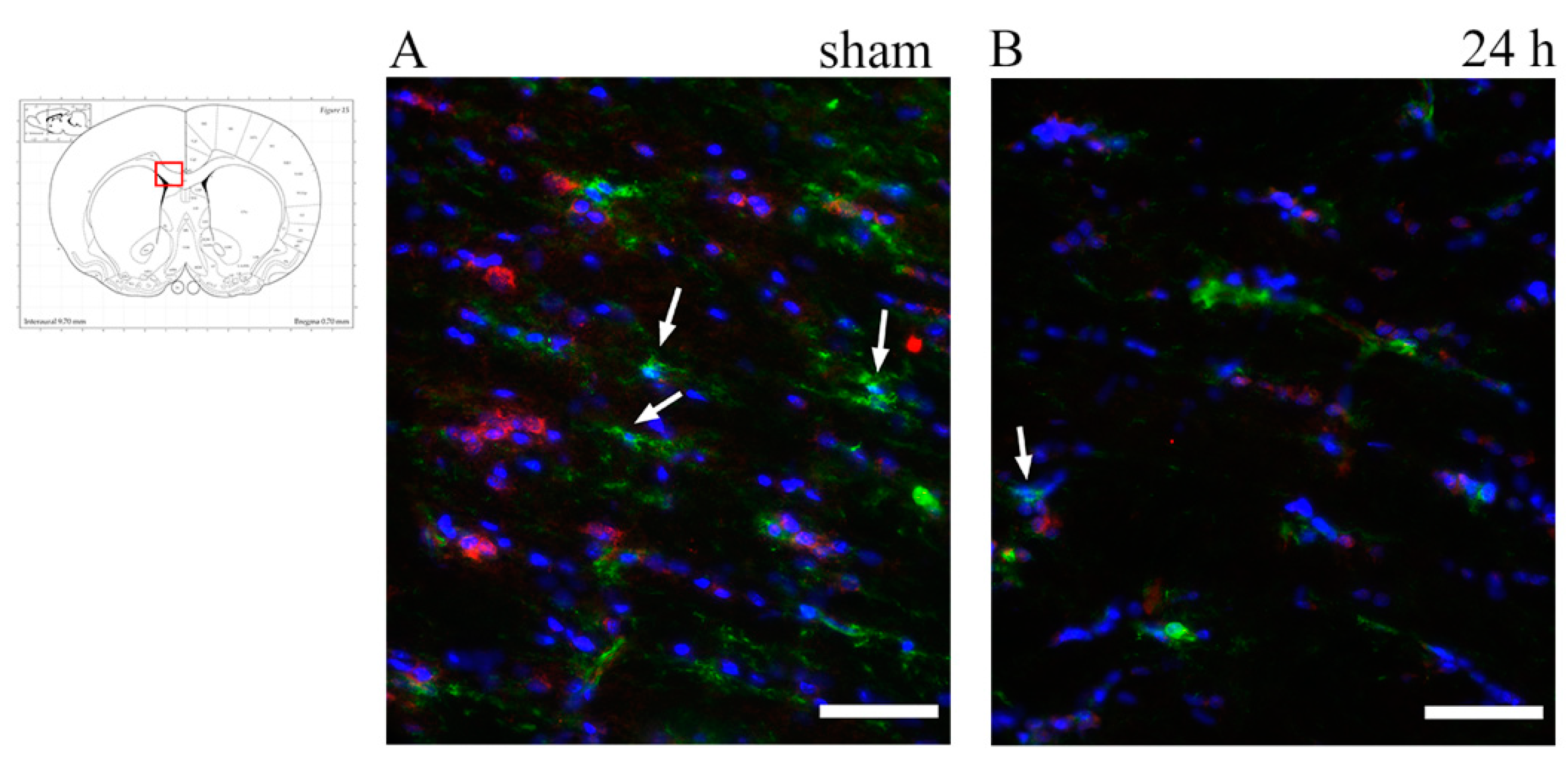 Brainsci 10 00229 g007a Brainsci 10 00229 g007a