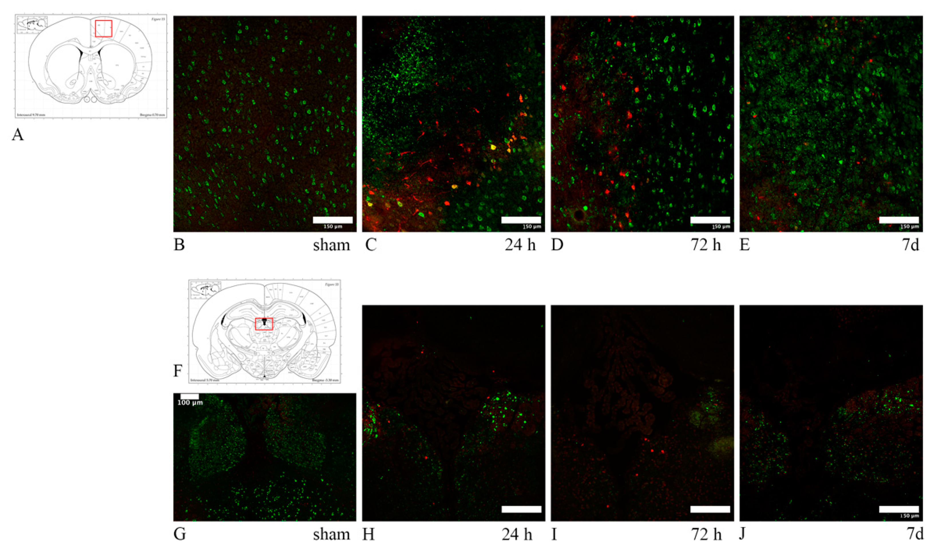 Brainsci 10 00229 g012 Brainsci 10 00229 g012