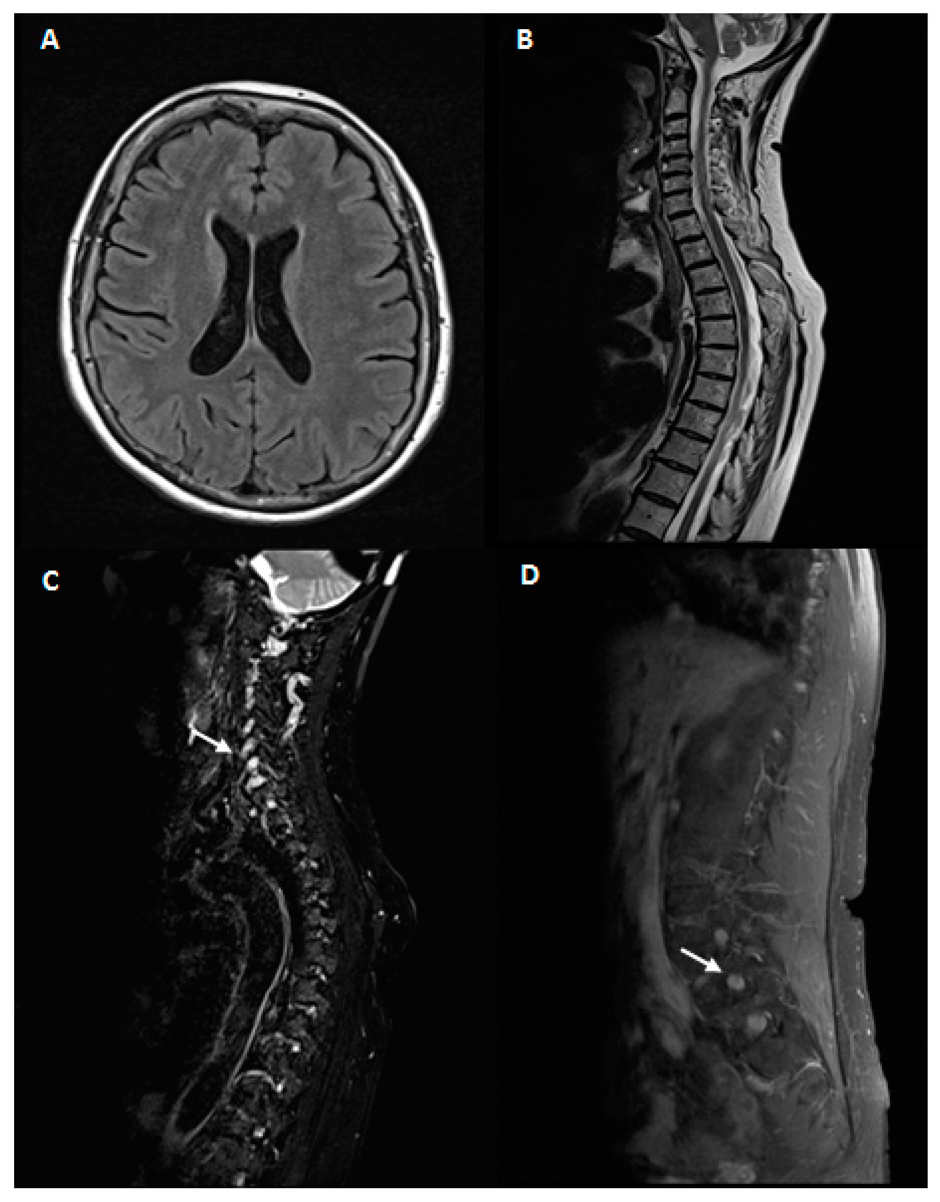 Brainsci 10 00282 g001