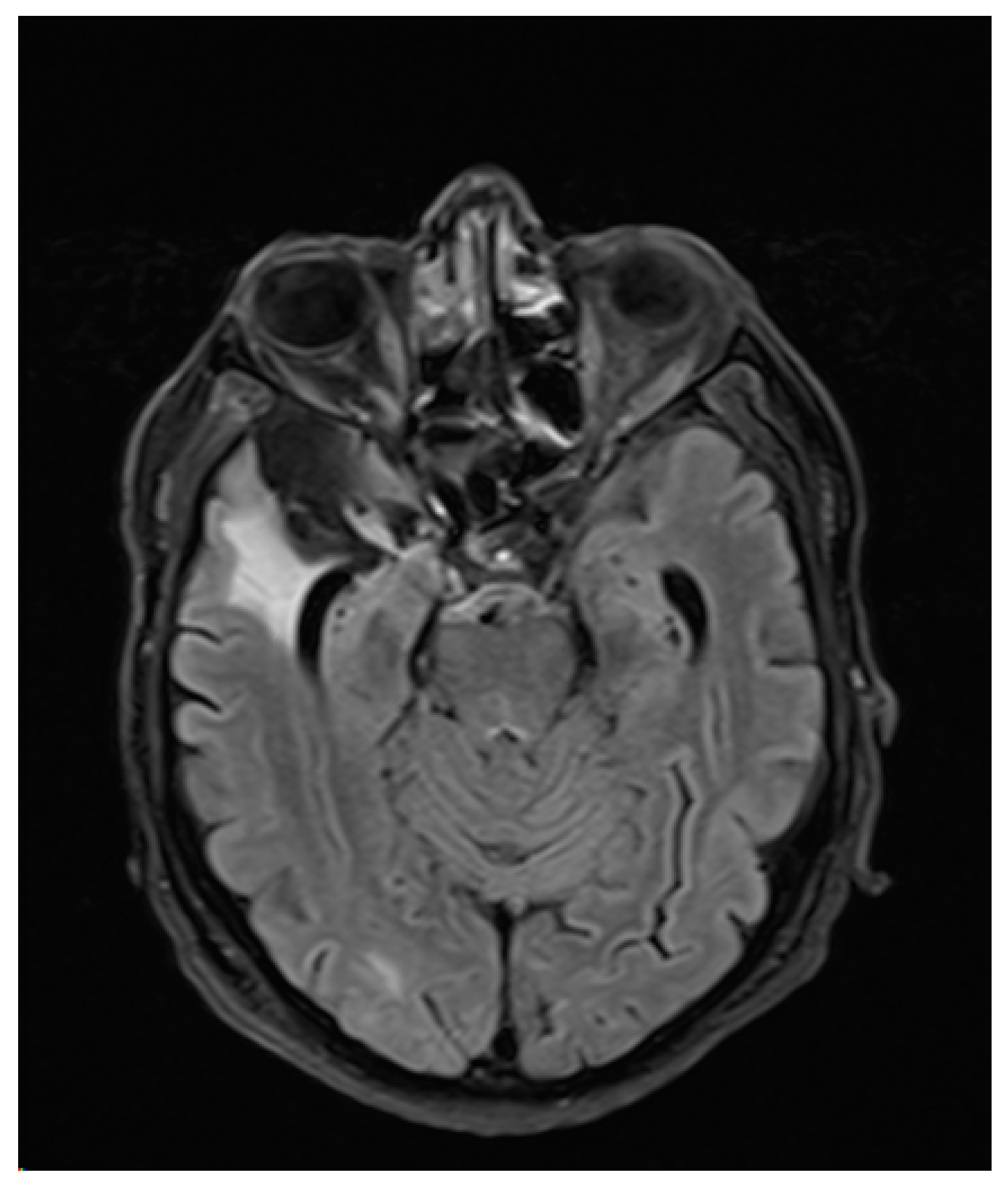 Brainsci 10 00298 g002 Brainsci 10 00298 g002