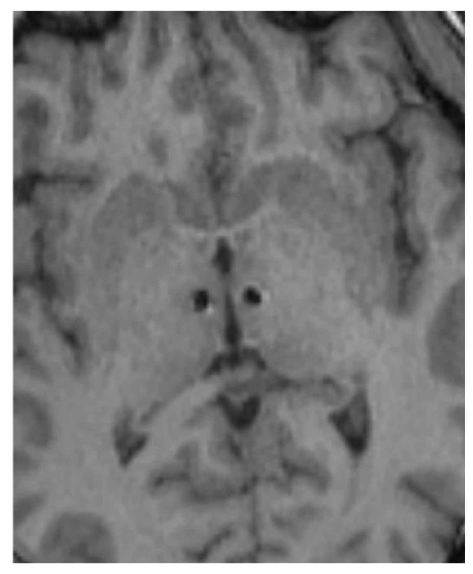 Brainsci 10 00301 g001