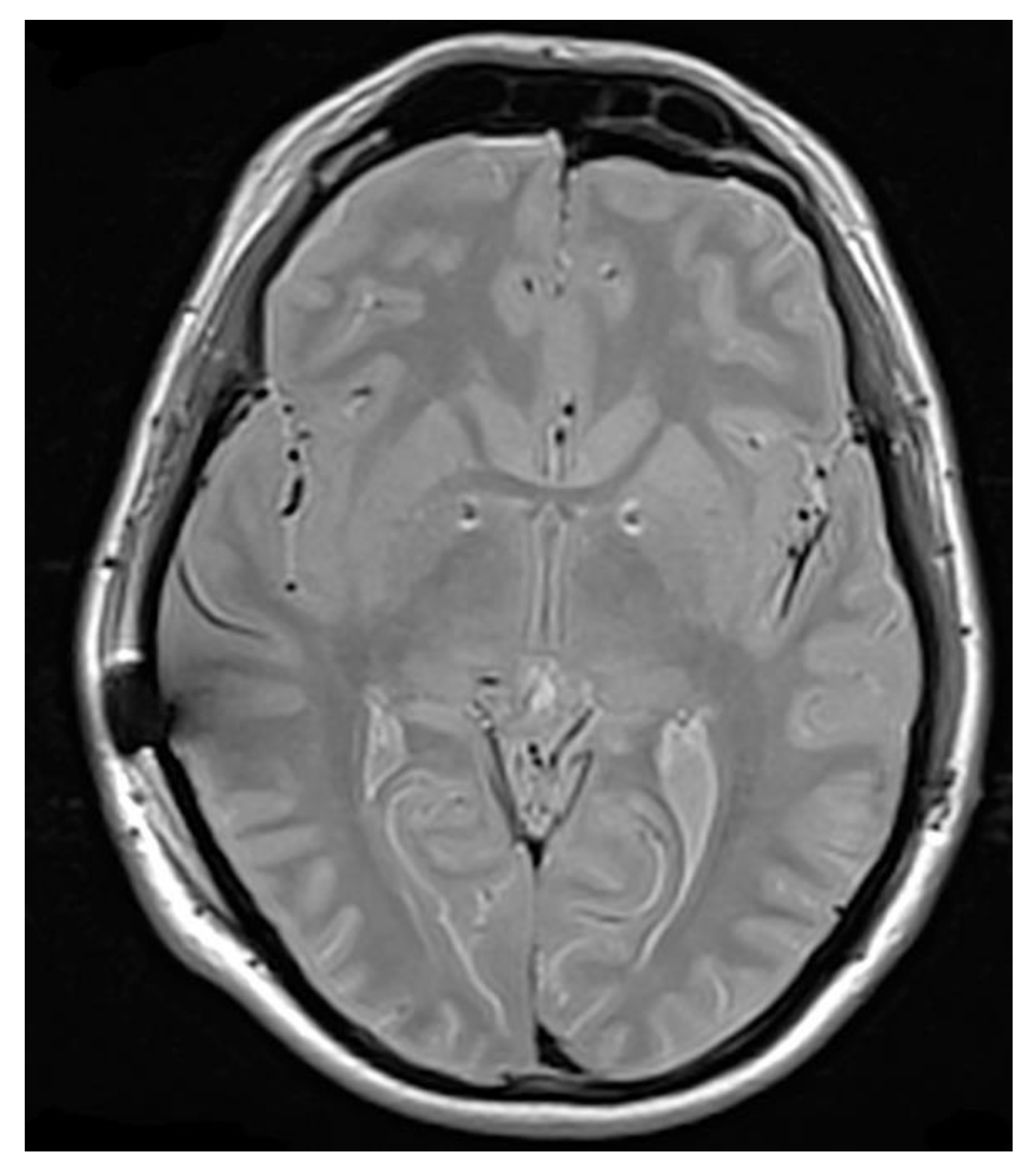 Brainsci 10 00301 g002