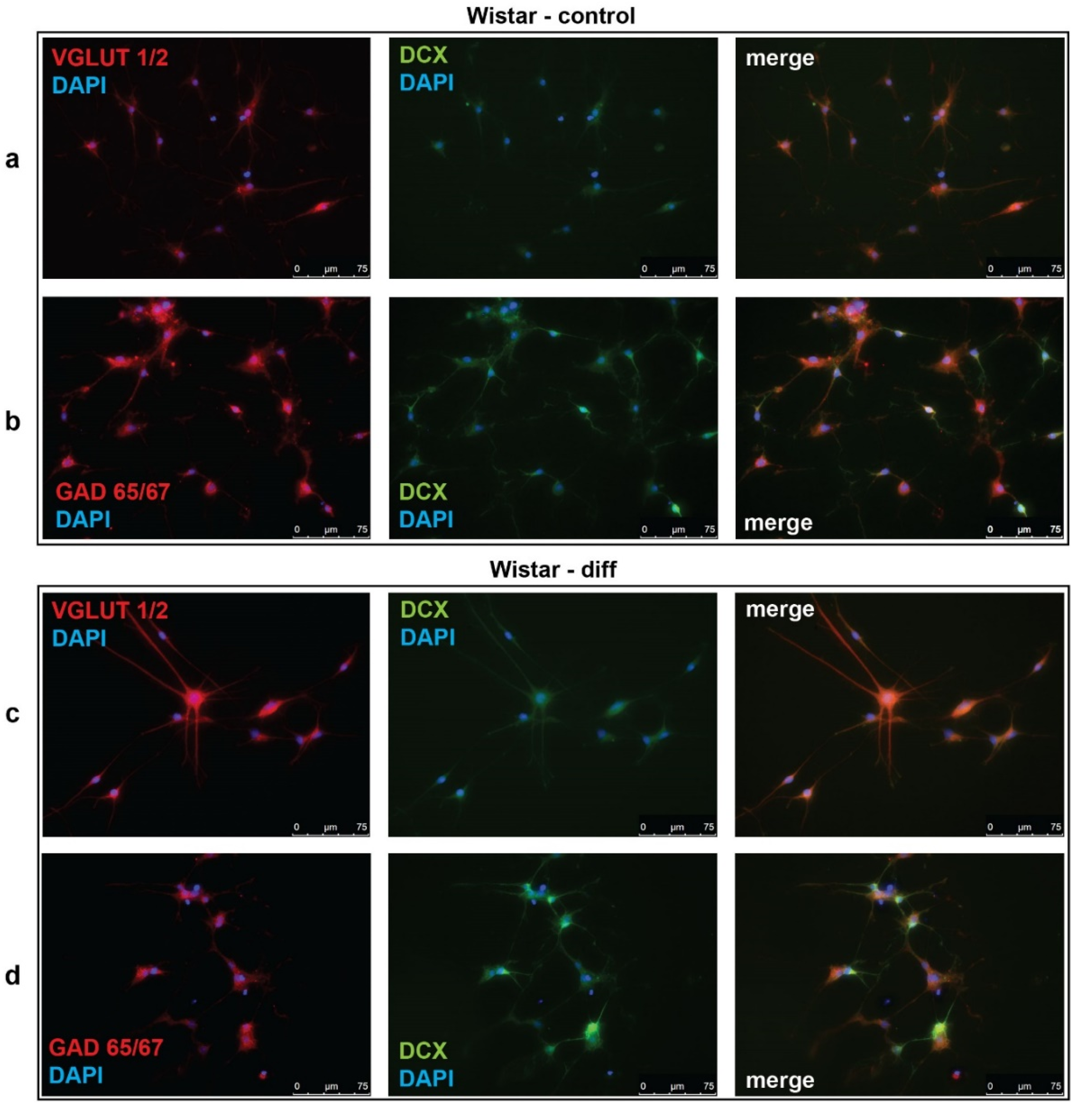 Brainsci 10 00311 g003 Brainsci 10 00311 g003