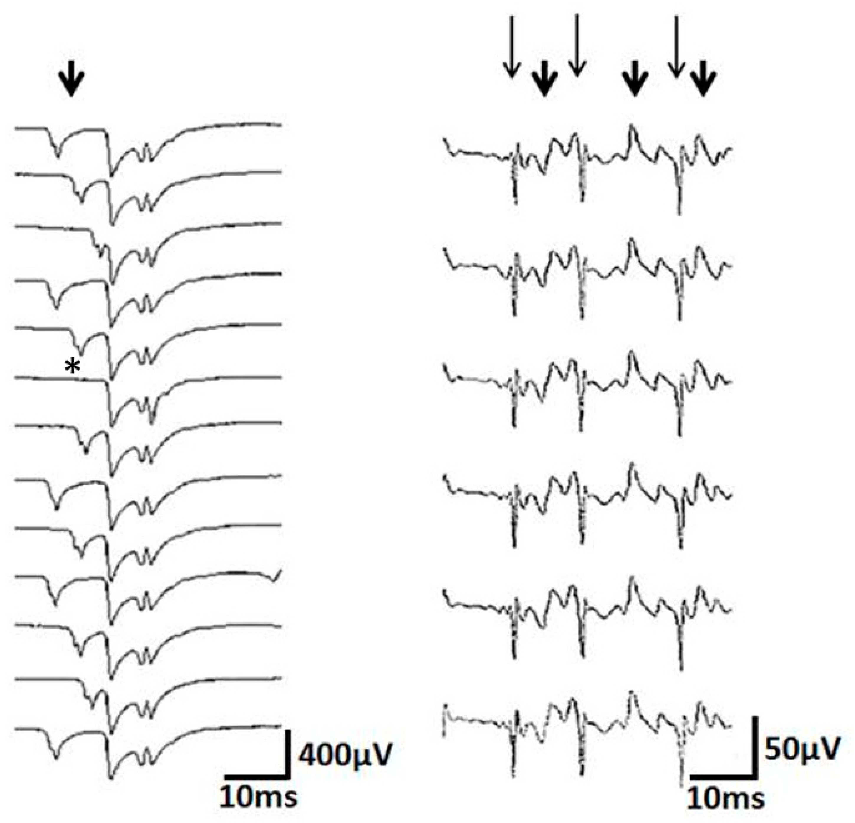 Brainsci 10 00349 g003 Brainsci 10 00349 g003
