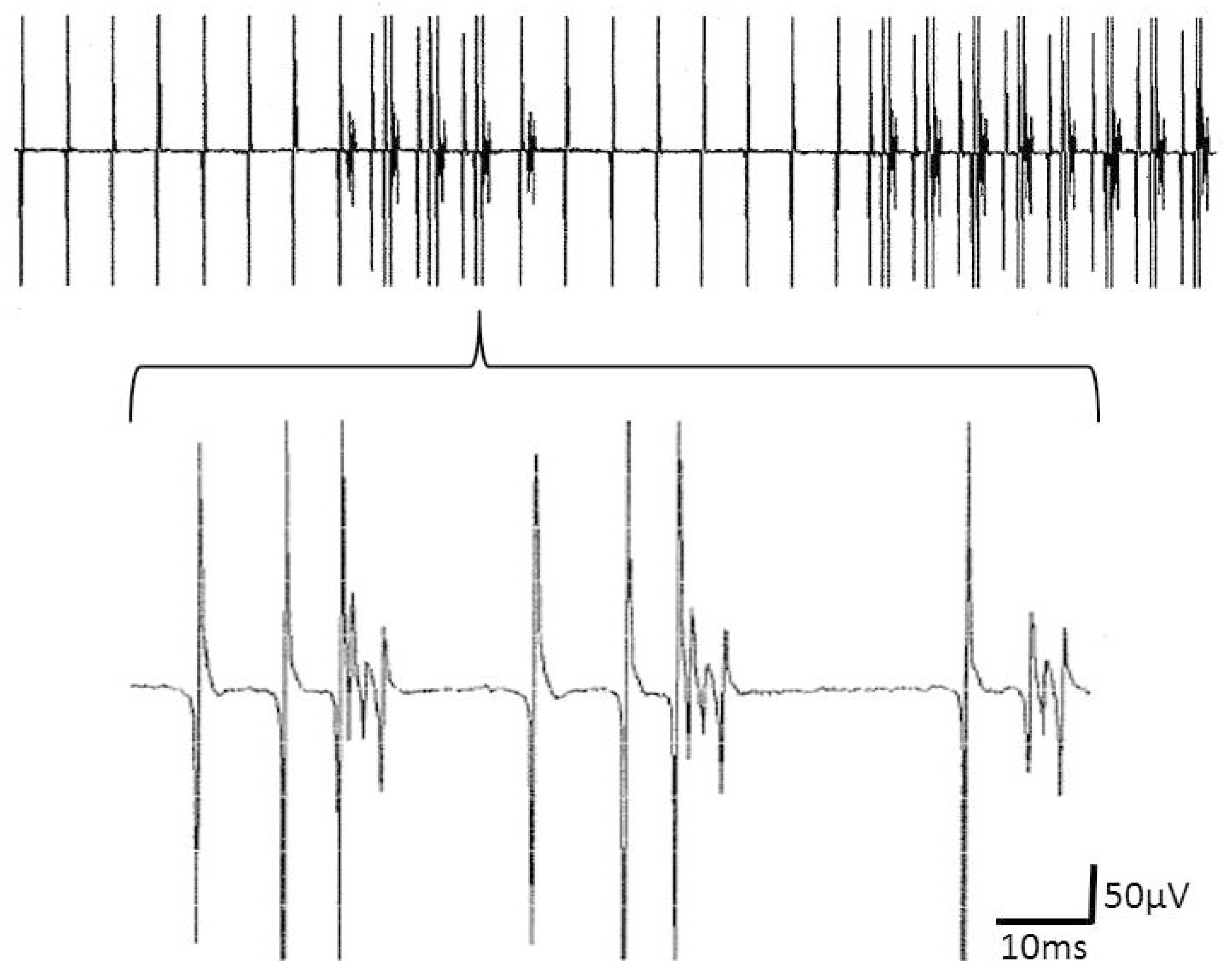 Brainsci 10 00349 g004 Brainsci 10 00349 g004