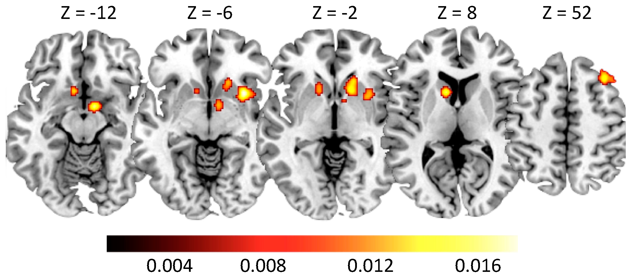 Brainsci 10 00353 g002 Brainsci 10 00353 g002