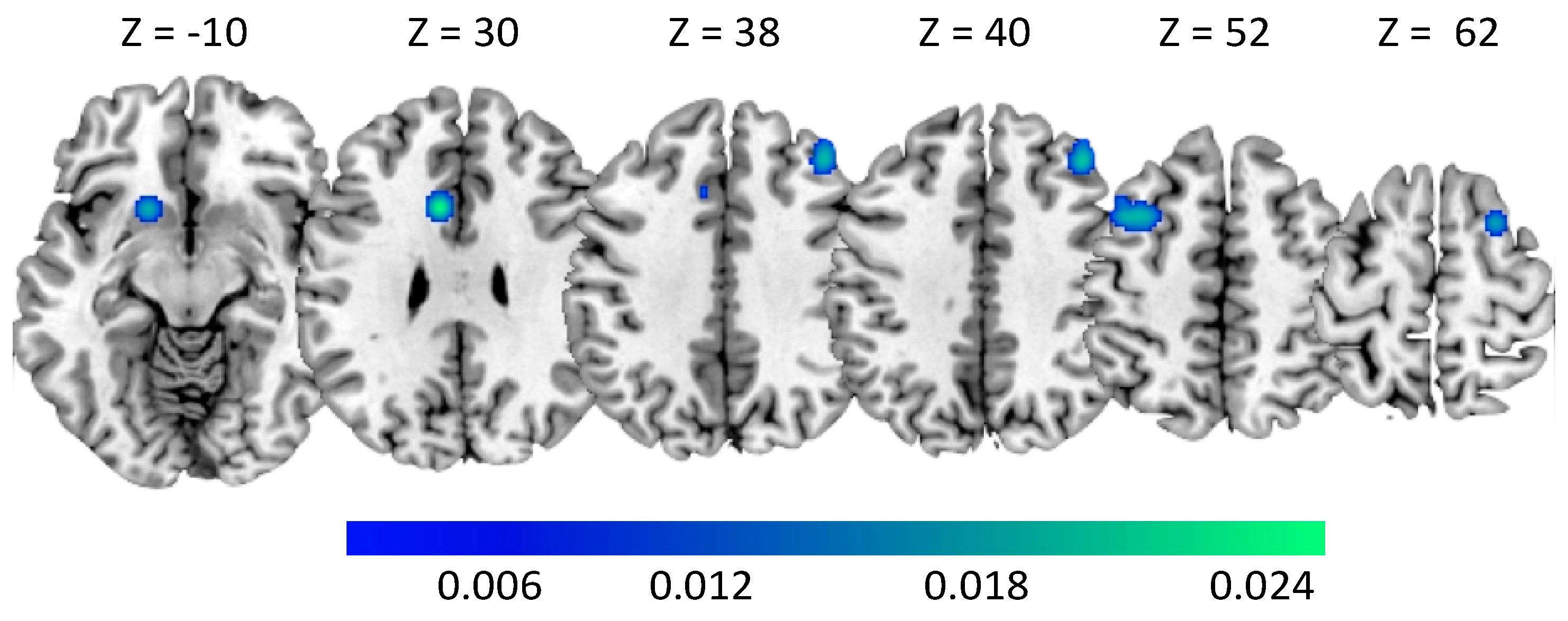 Brainsci 10 00353 g004 Brainsci 10 00353 g004