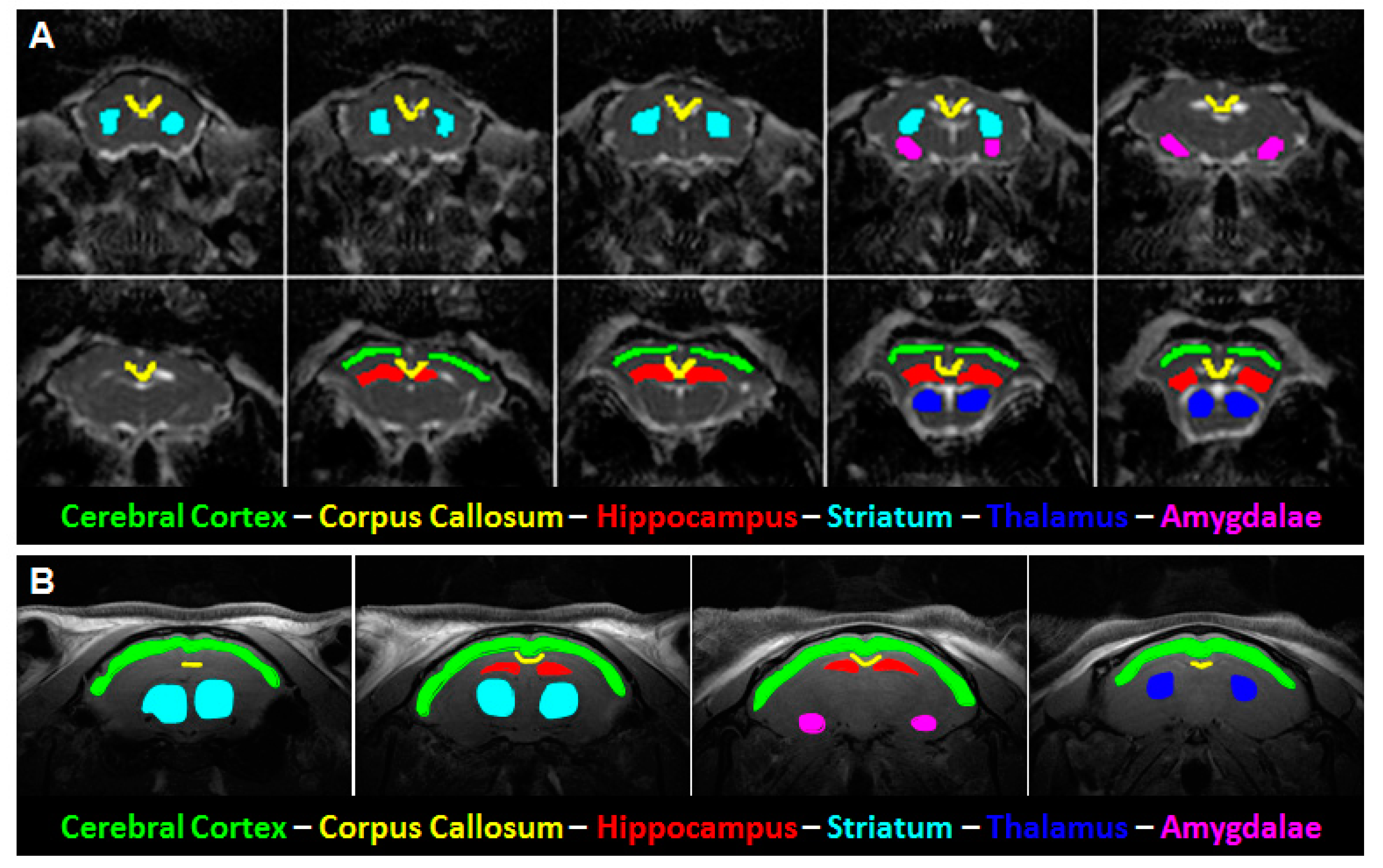 Brainsci 10 00365 g001