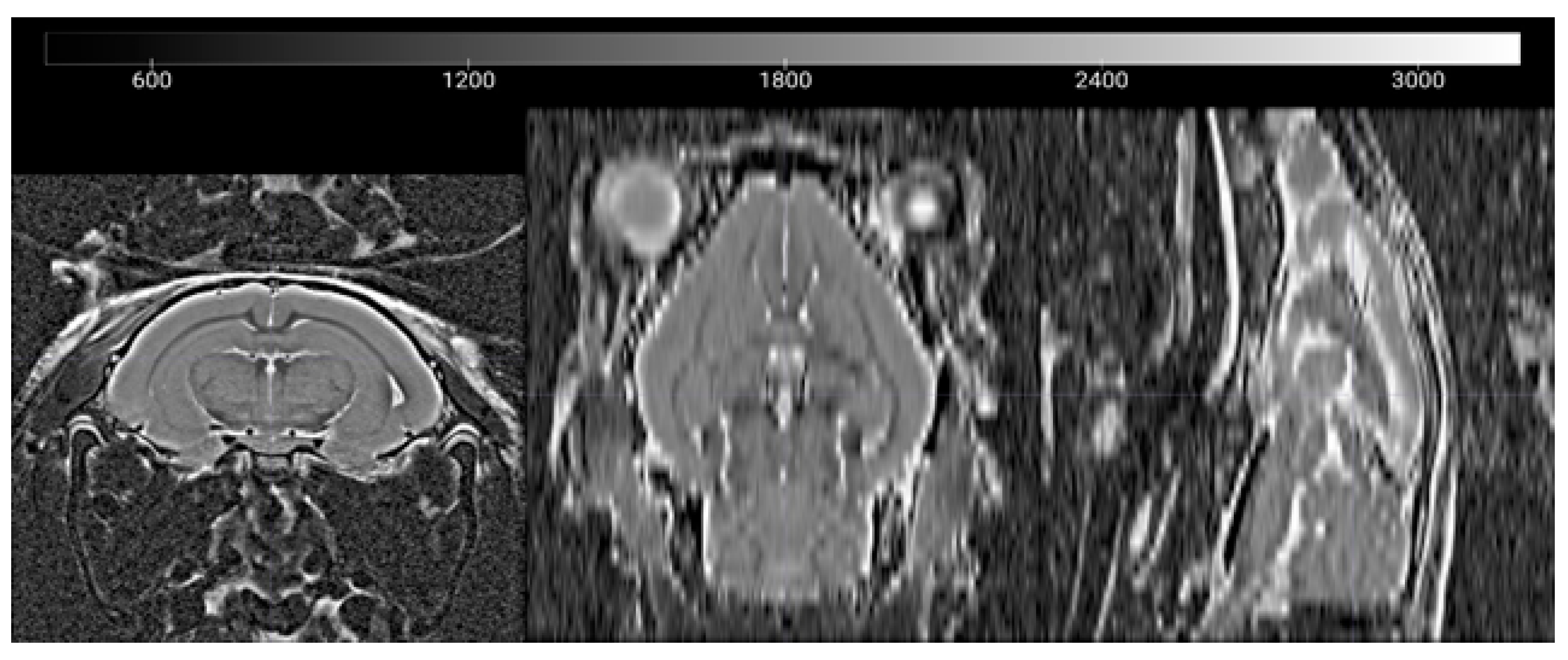 Brainsci 10 00365 g0a1