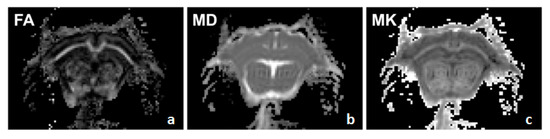 Brainsci 10 00365 g0a2