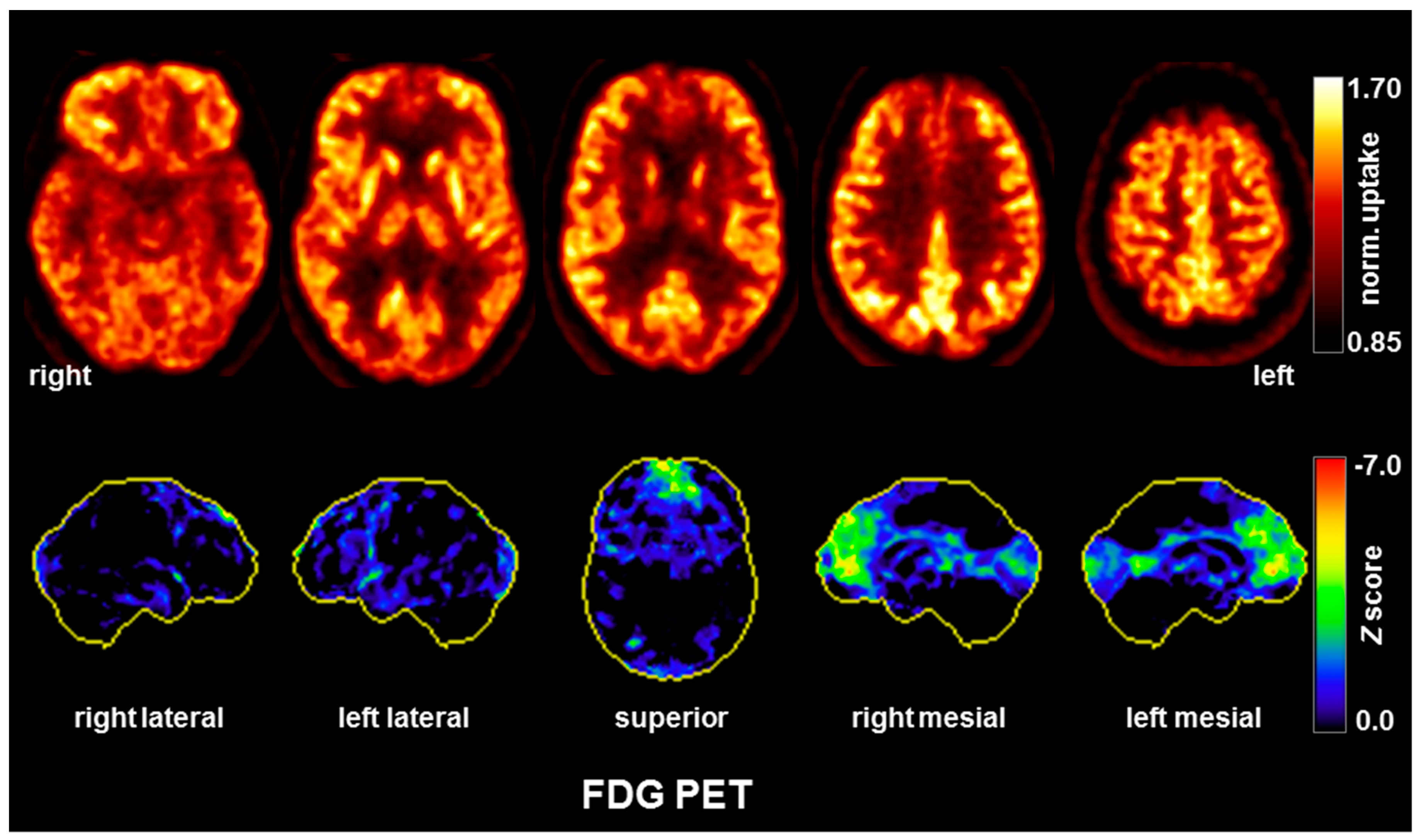 Brainsci 10 00375 g003 Brainsci 10 00375 g003