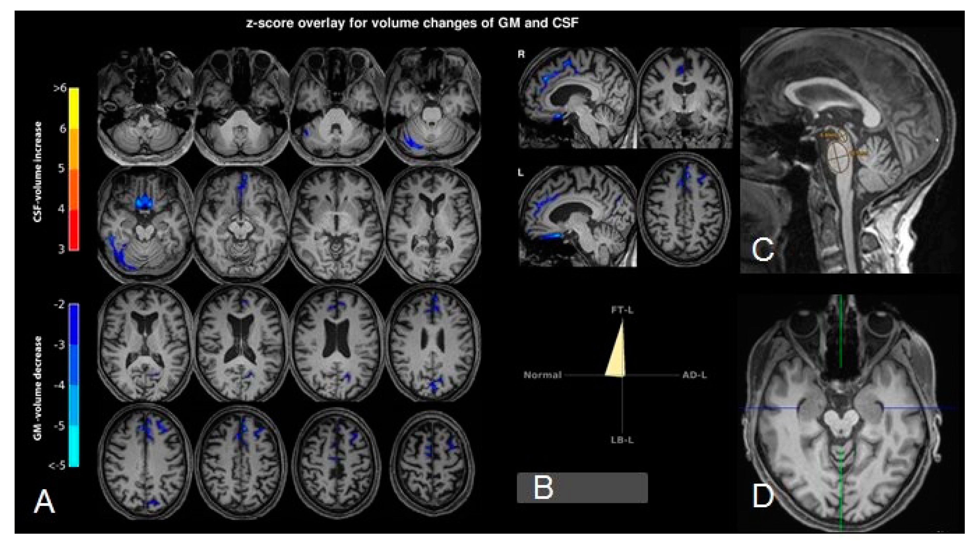 Brainsci 10 00399 g002 Brainsci 10 00399 g002