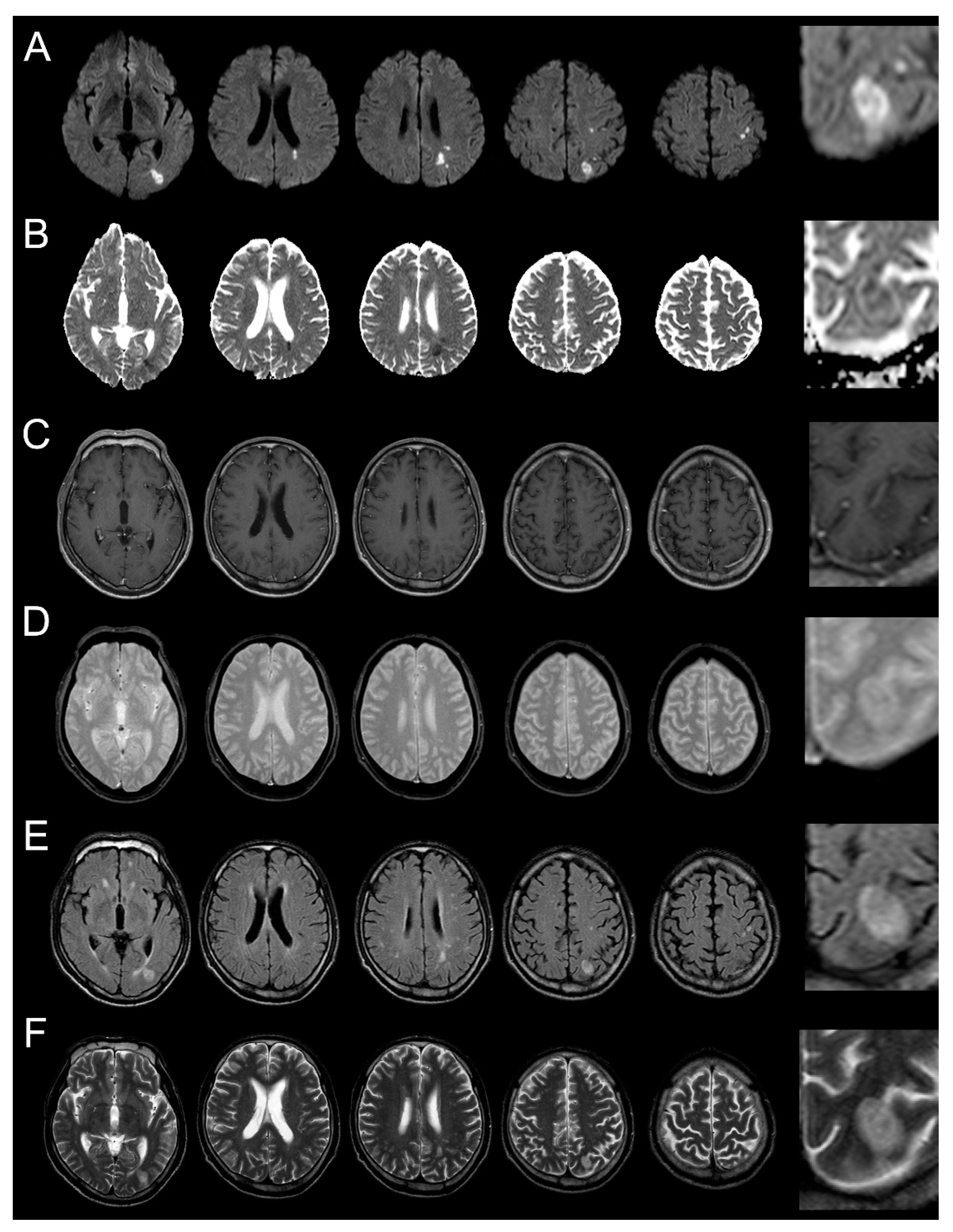 Brainsci 10 00440 g001