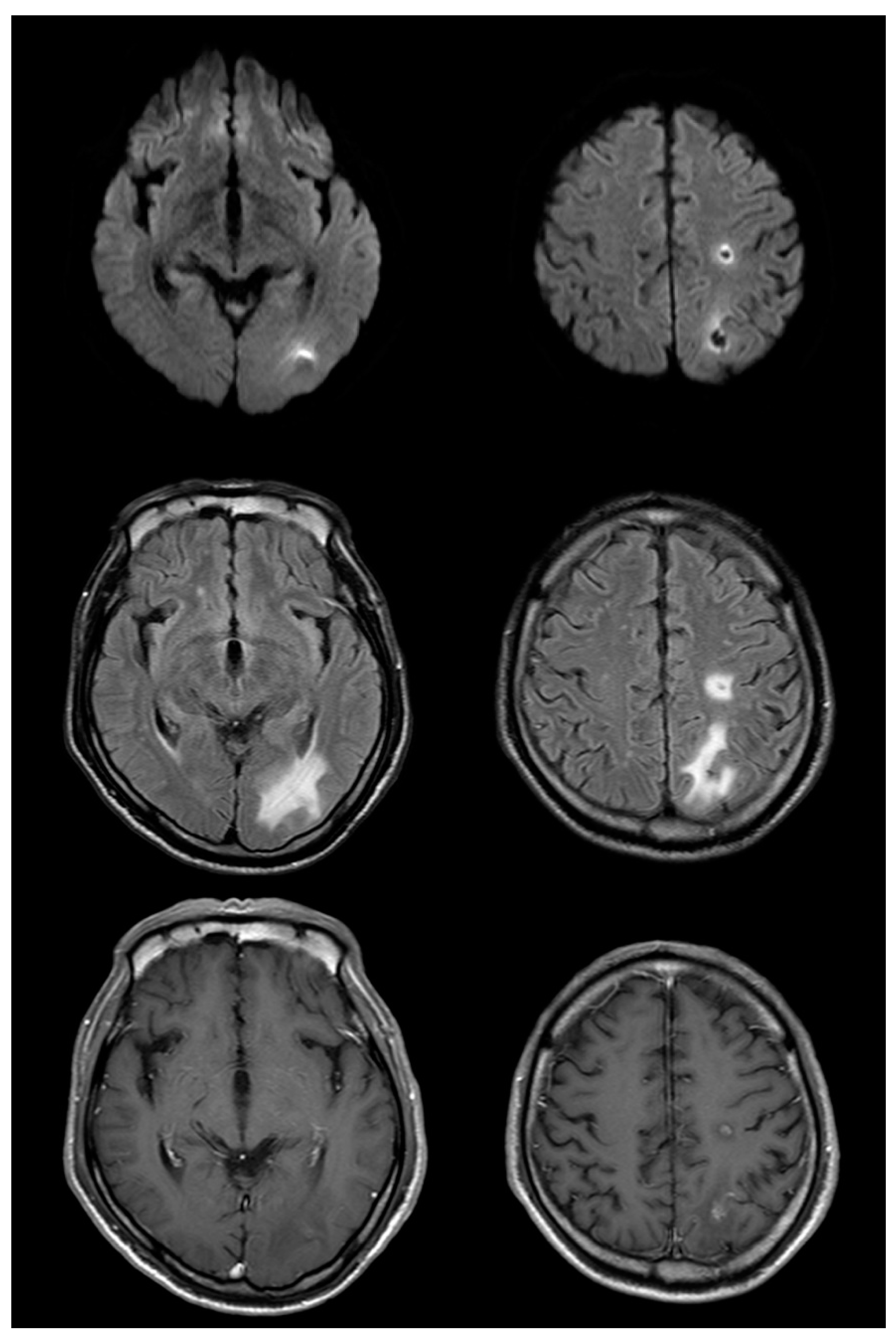 Brainsci 10 00440 g003