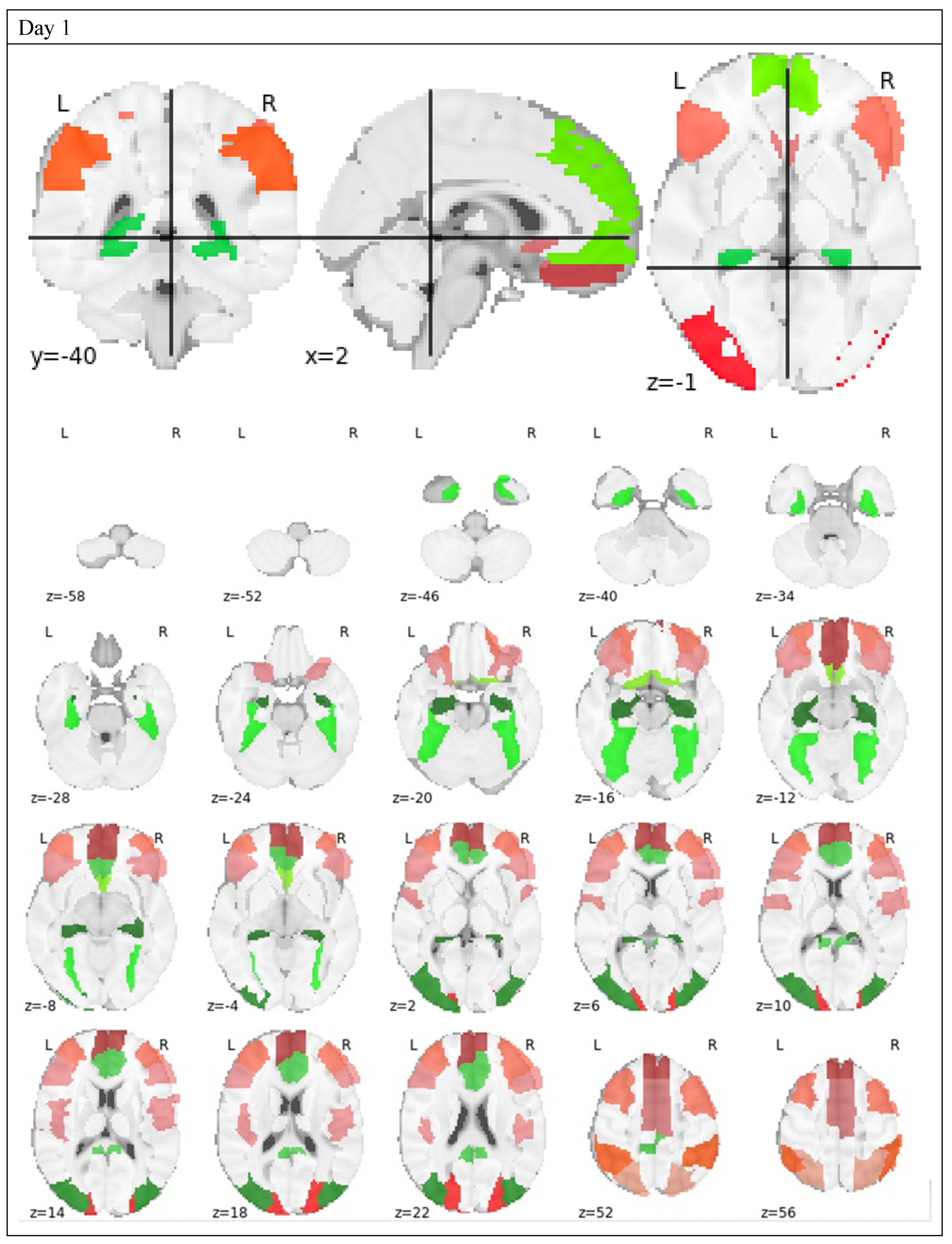 Brainsci 10 00456 g003a