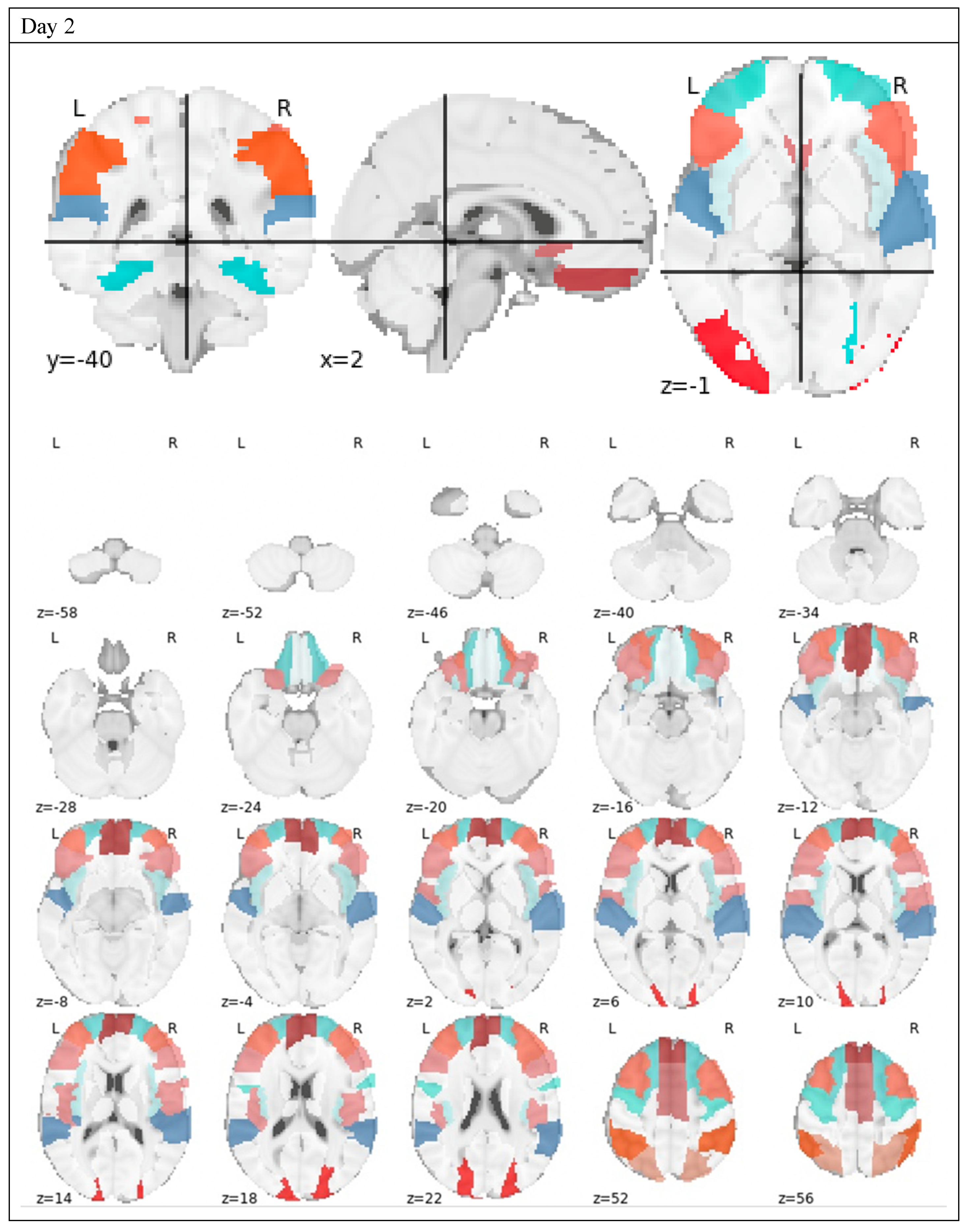 Brainsci 10 00456 g003b