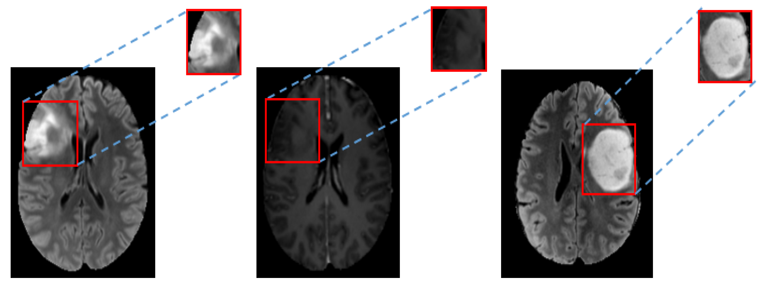 Brainsci 10 00463 g005